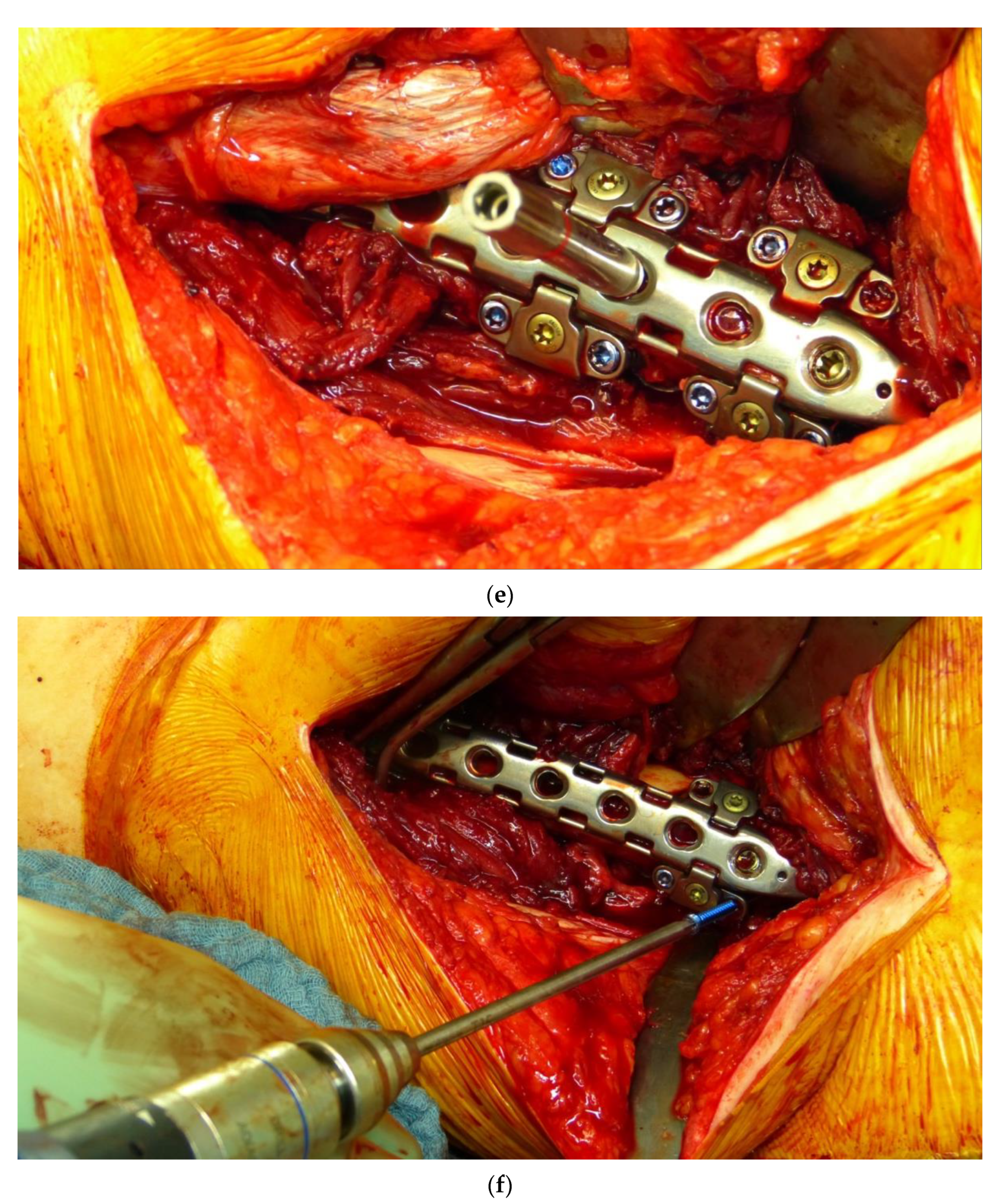 Jcm 11 01371 g003c 550