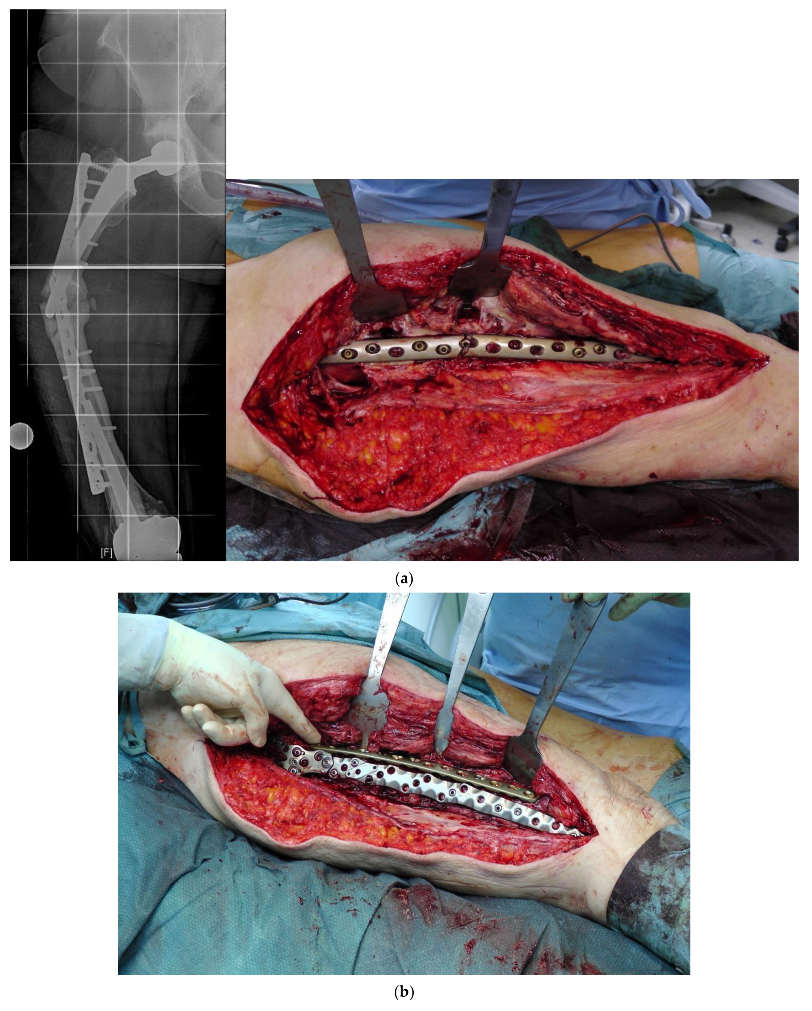 Jcm 11 01371 g004a 550