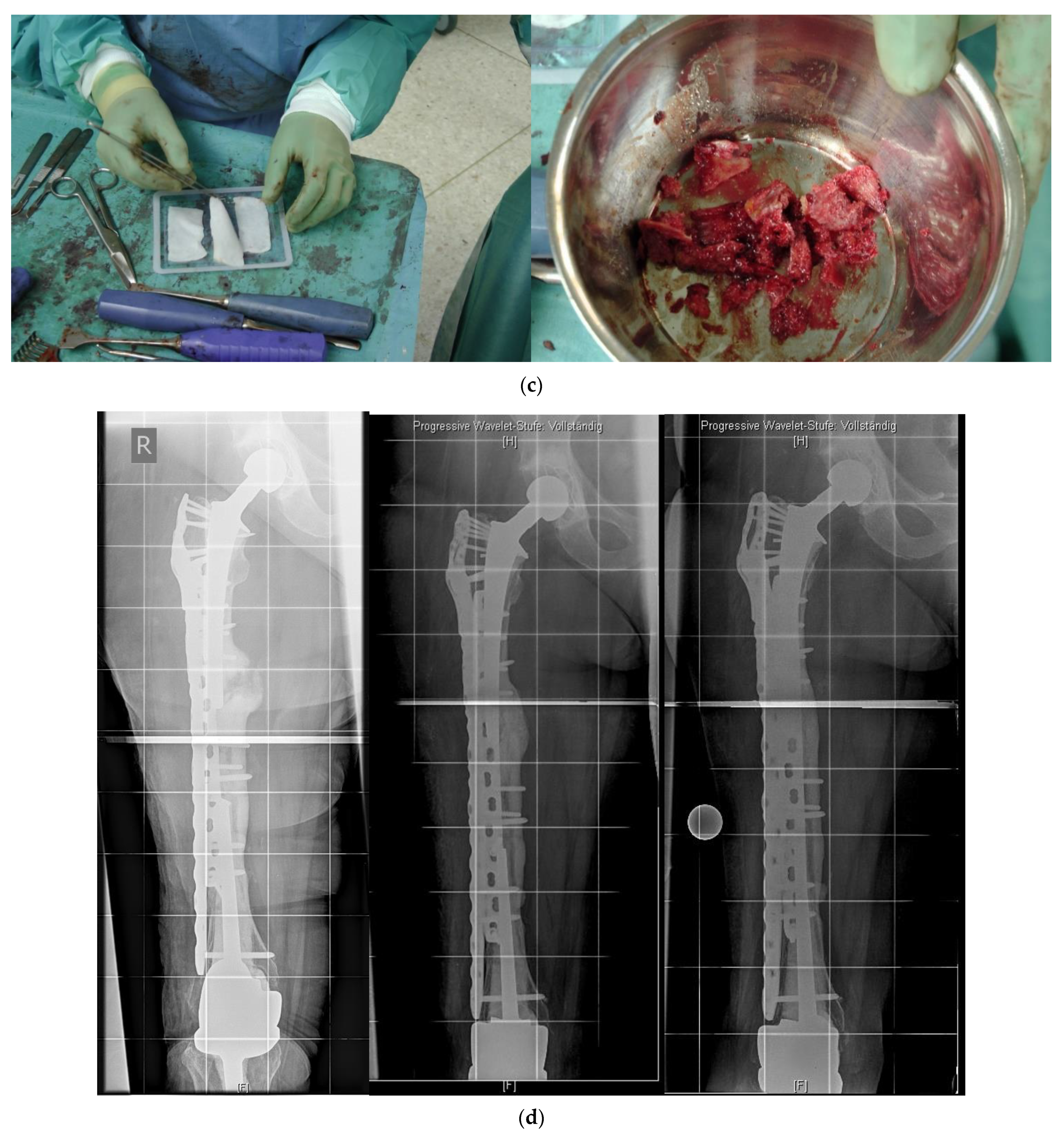 Jcm 11 01371 g004b 550