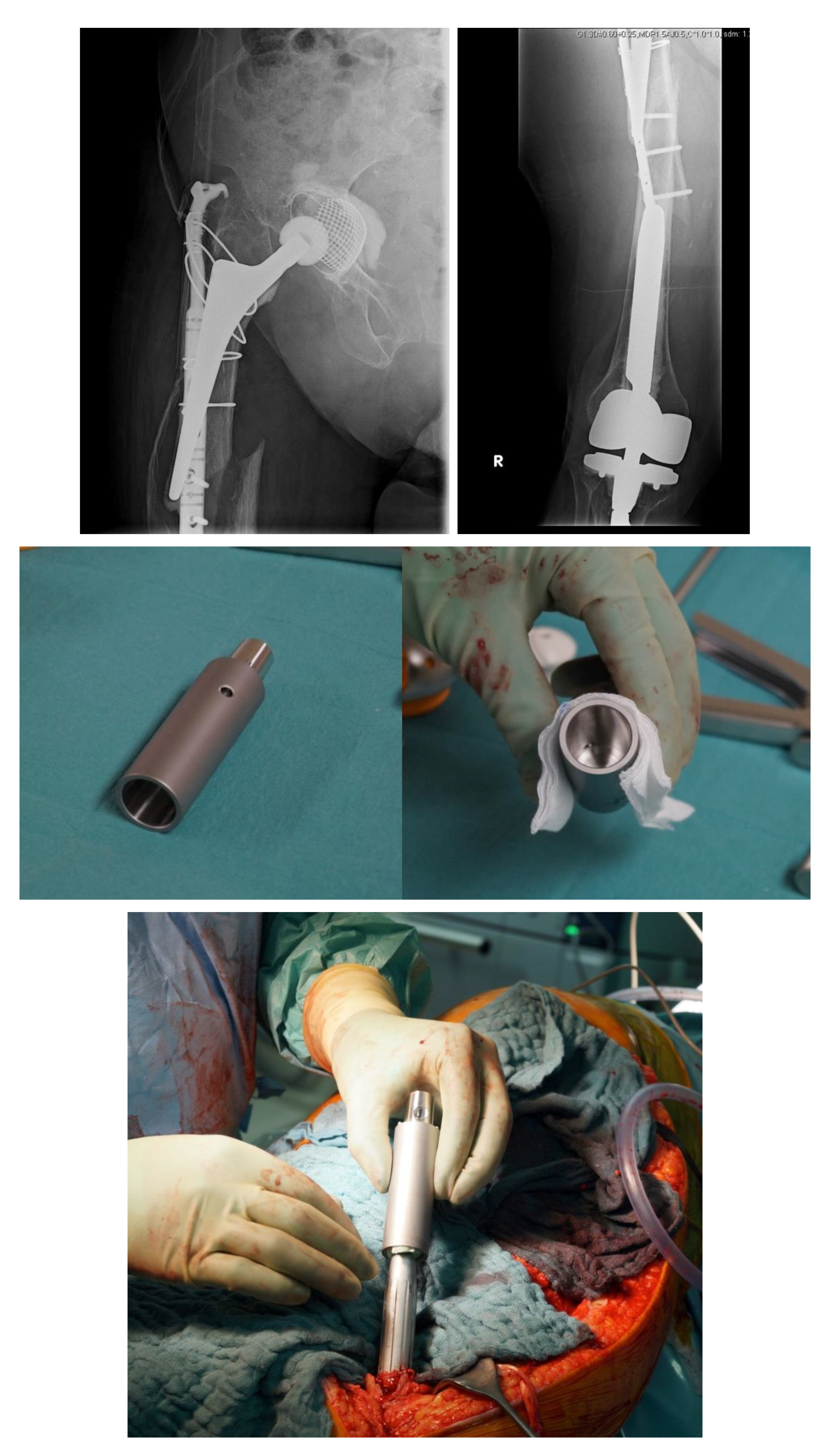 Jcm 11 01371 g006a 550