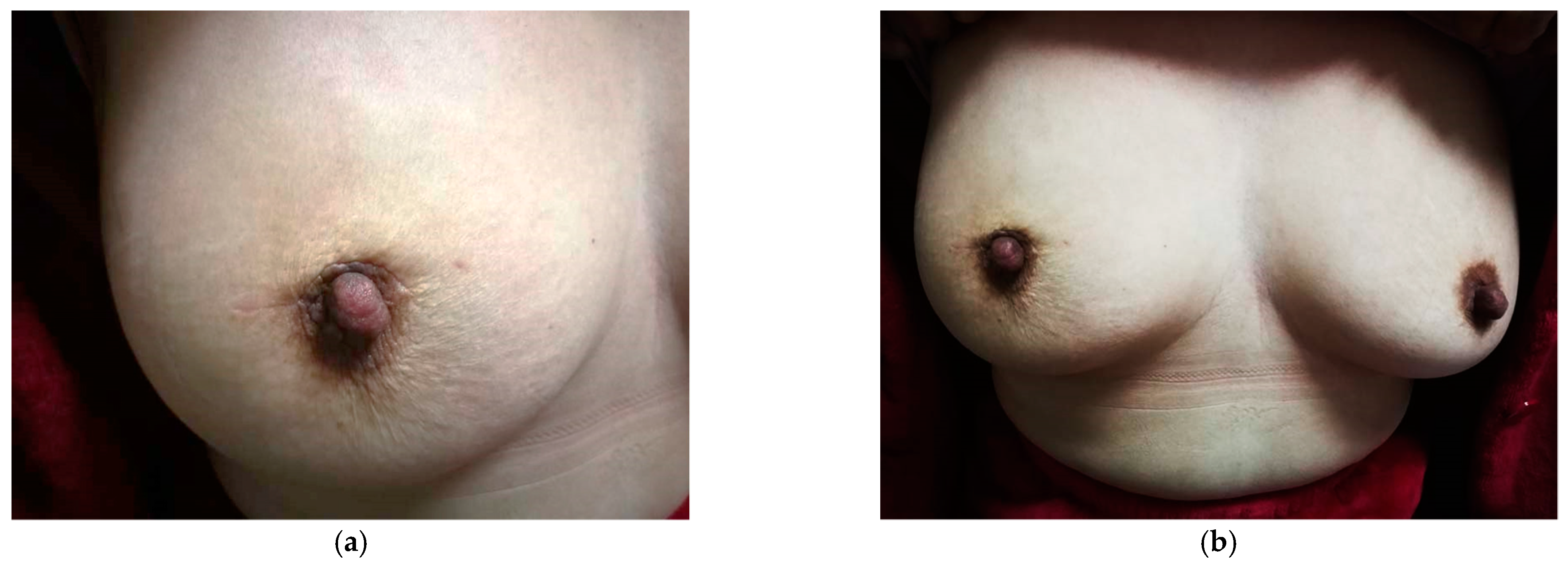 Jcm 11 01379 g002 550