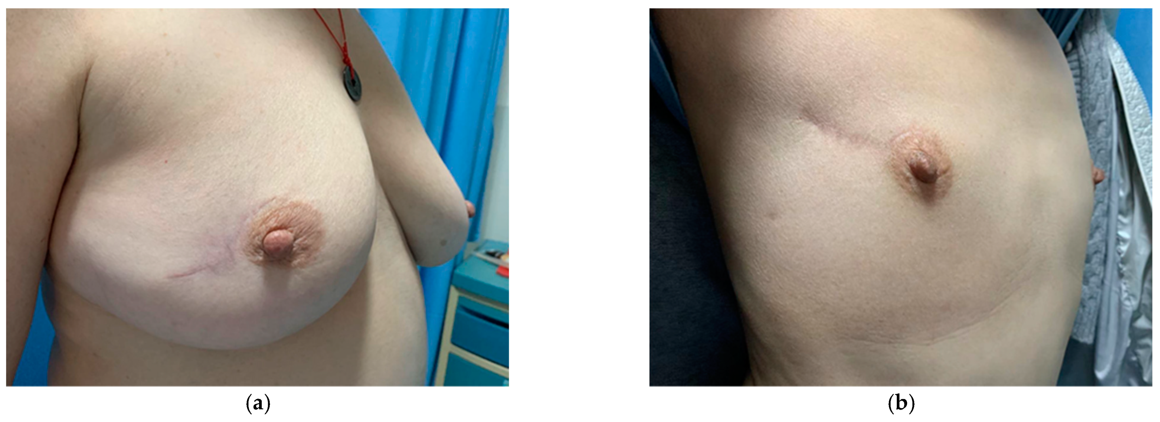 Jcm 11 01379 g003 550