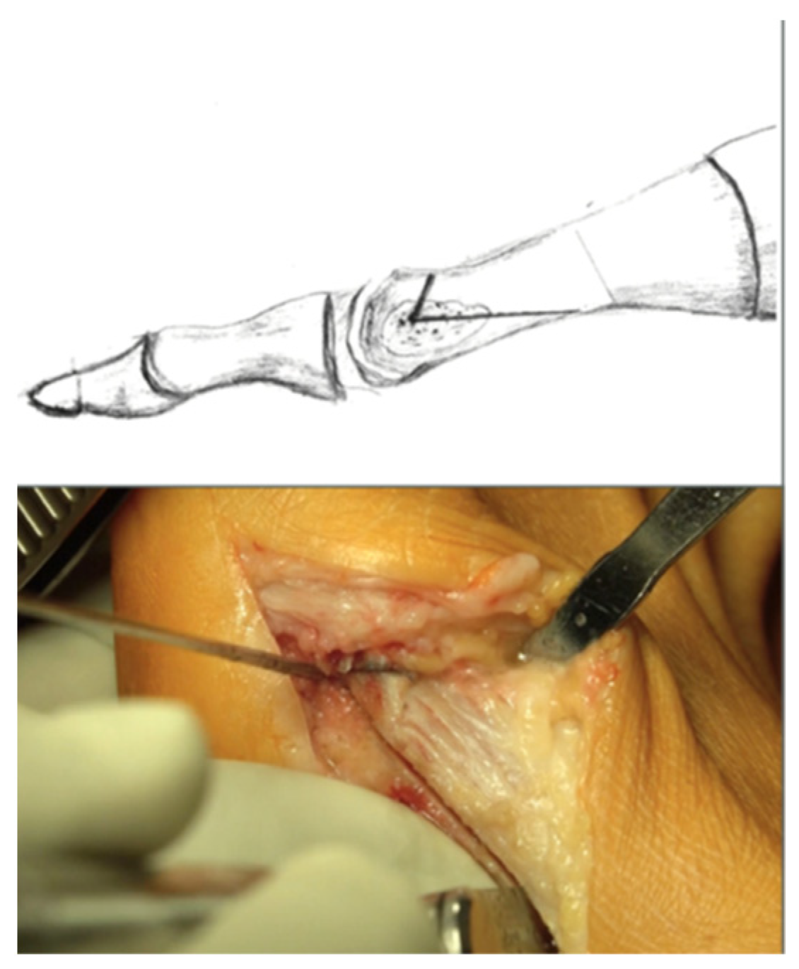 Jcm 11 01384 g001 550