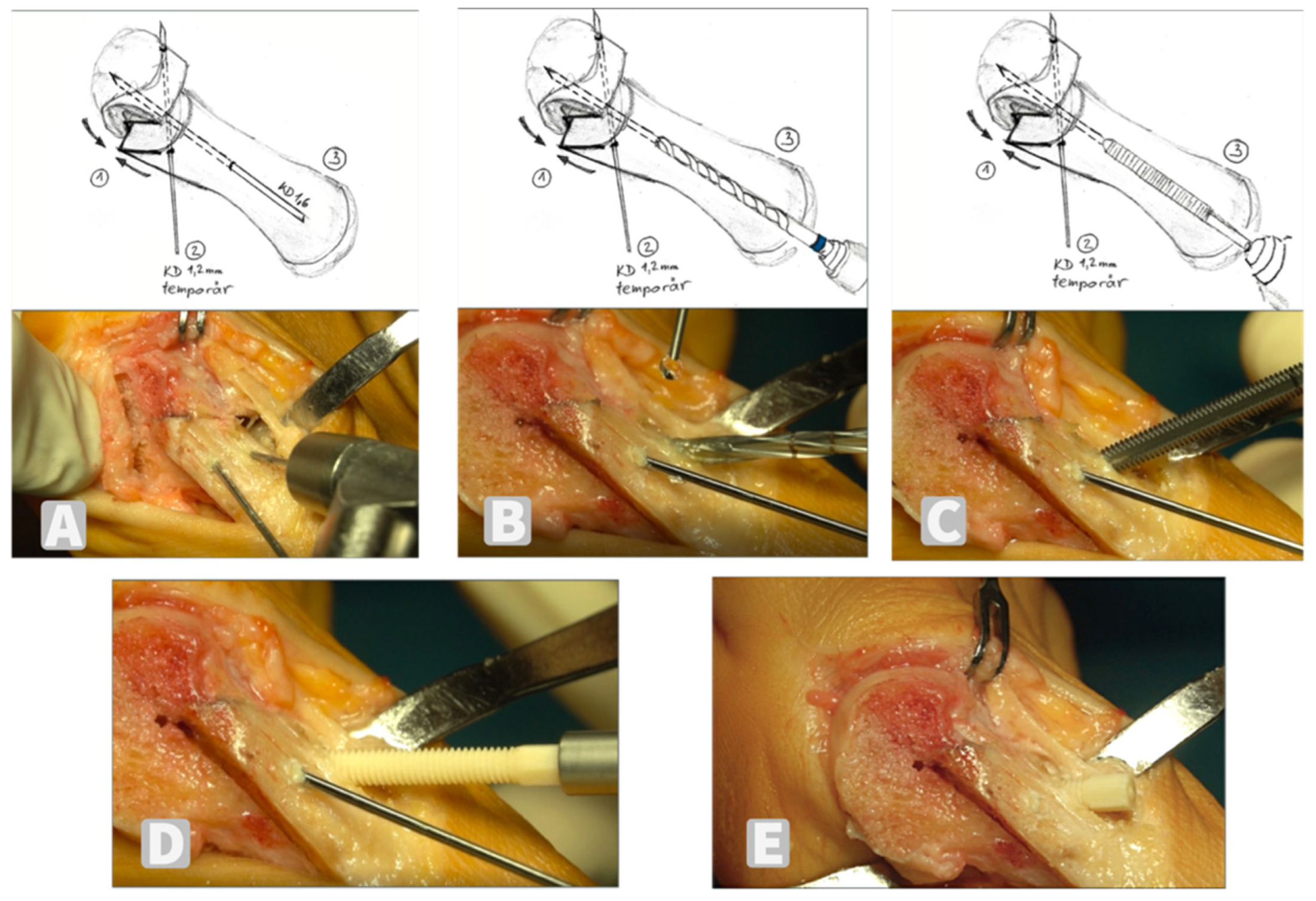 Jcm 11 01384 g002 550