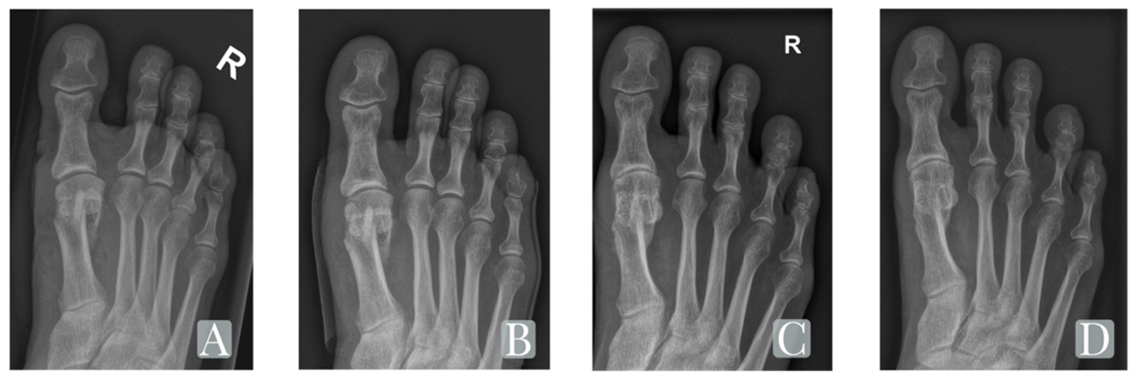 Jcm 11 01384 g003 550