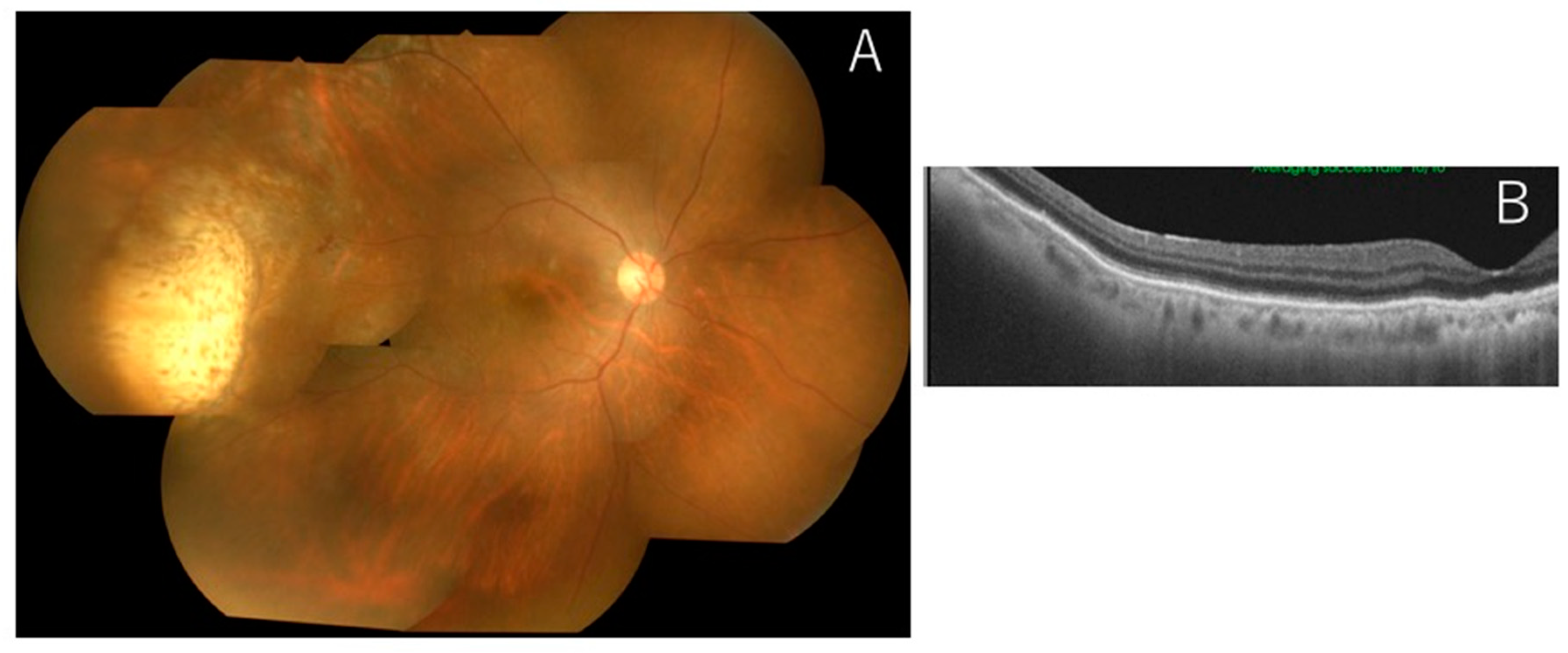 Jcm 11 01391 g003 550