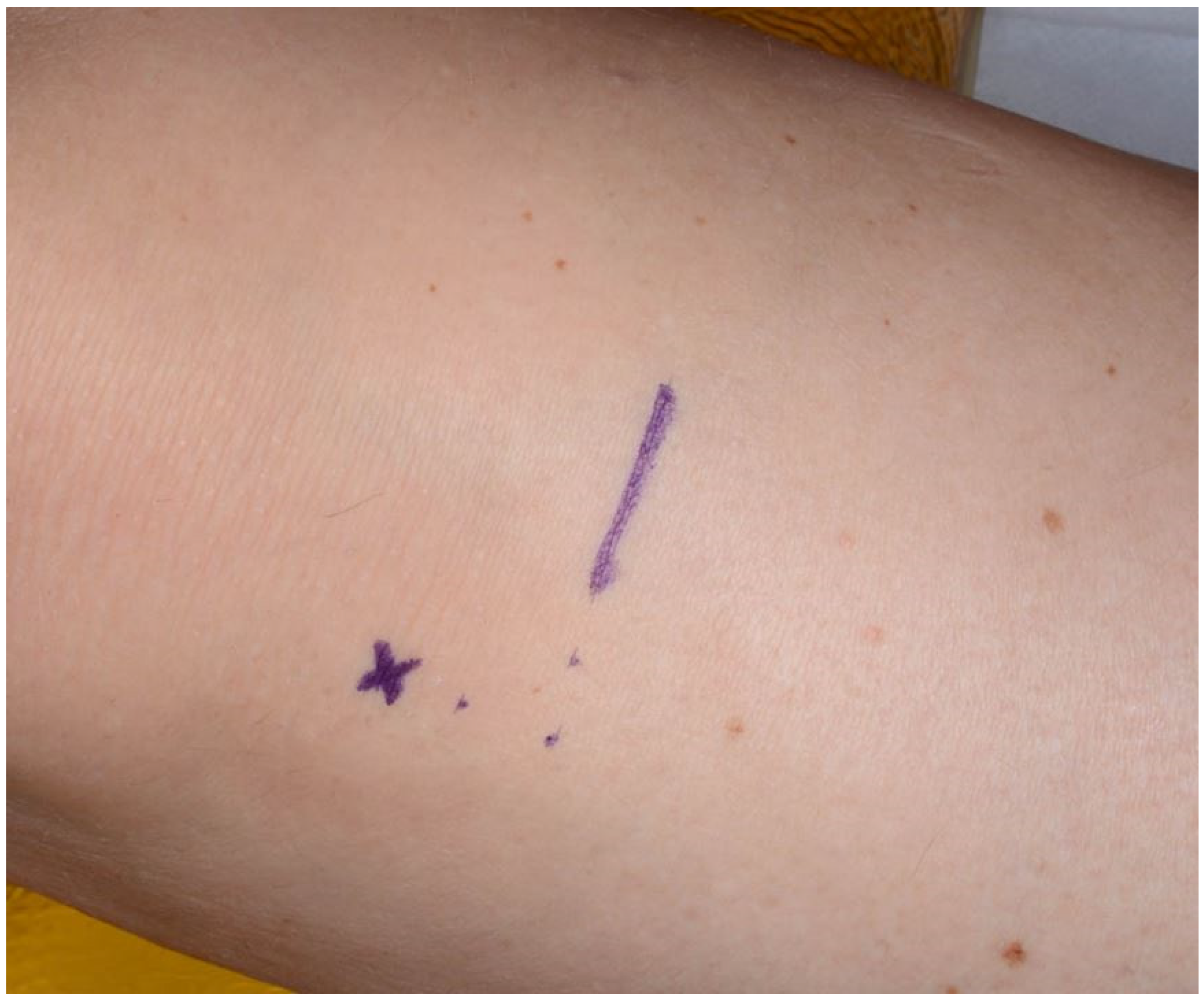 Jcm 11 01493 g001 550