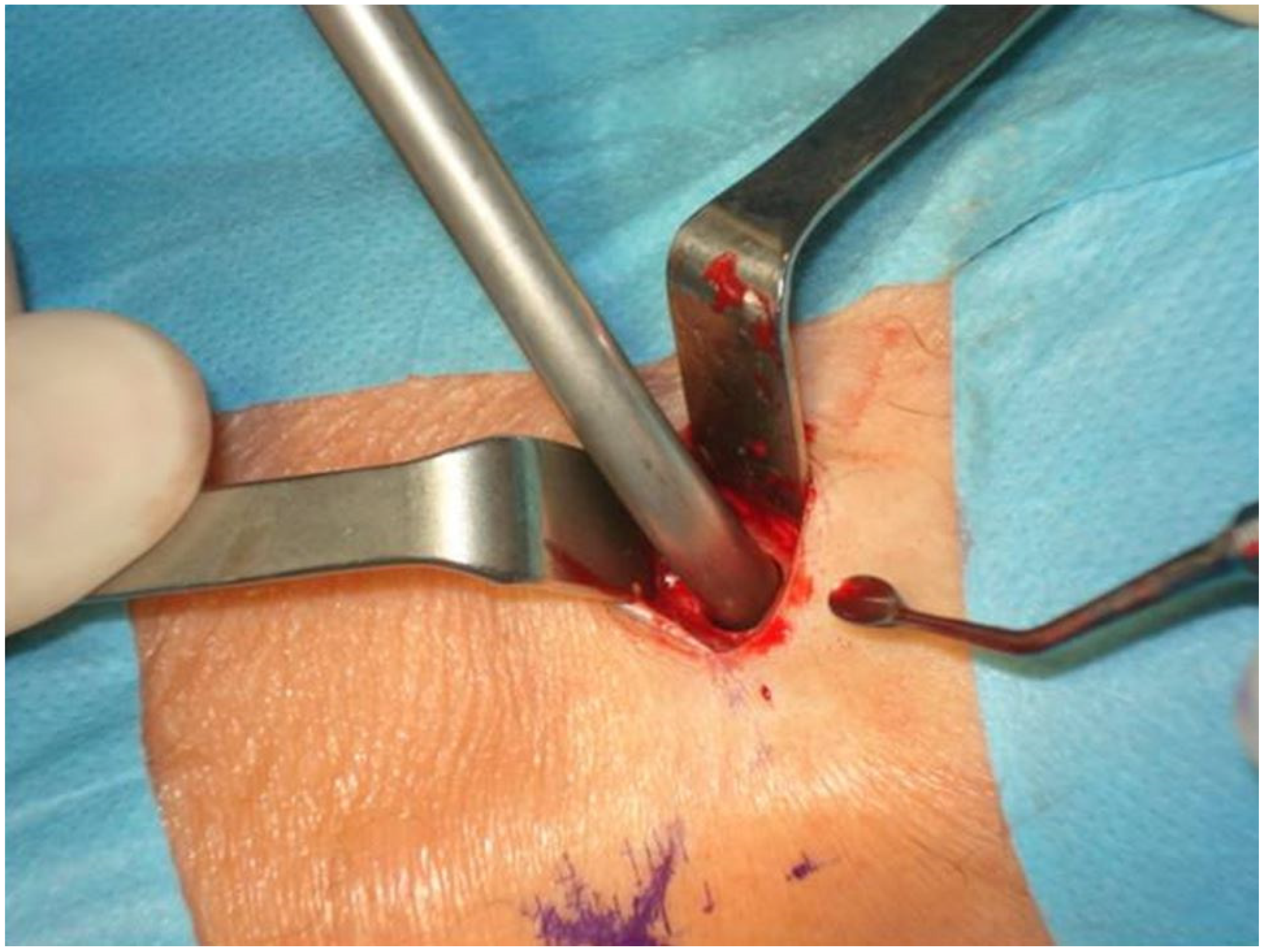 Jcm 11 01493 g003 550