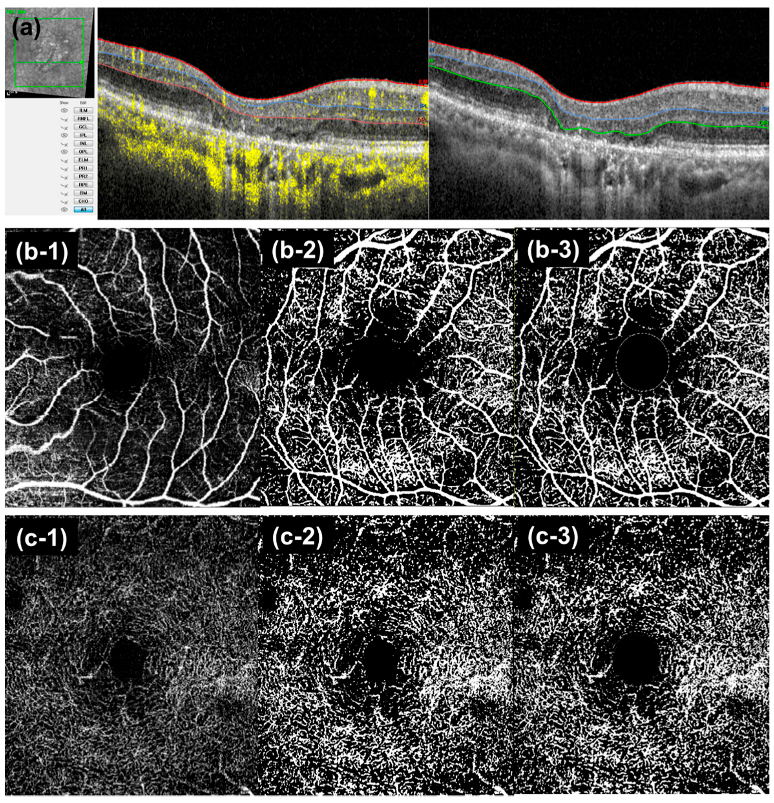 Jcm 11 01501 g001 Jcm 11 01501 g001