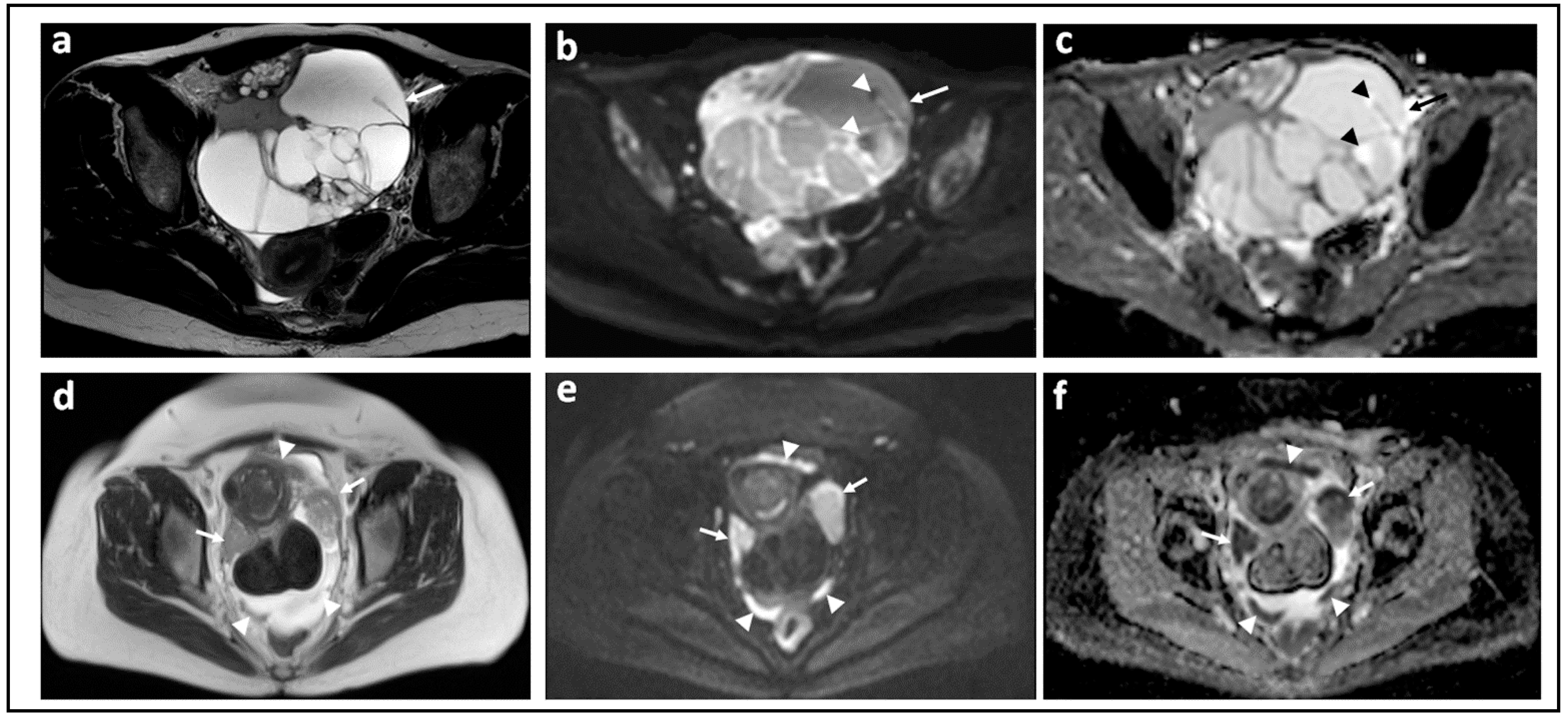 Jcm Free Full Text Diffusion Weighted Magnetic Resonance Imaging In