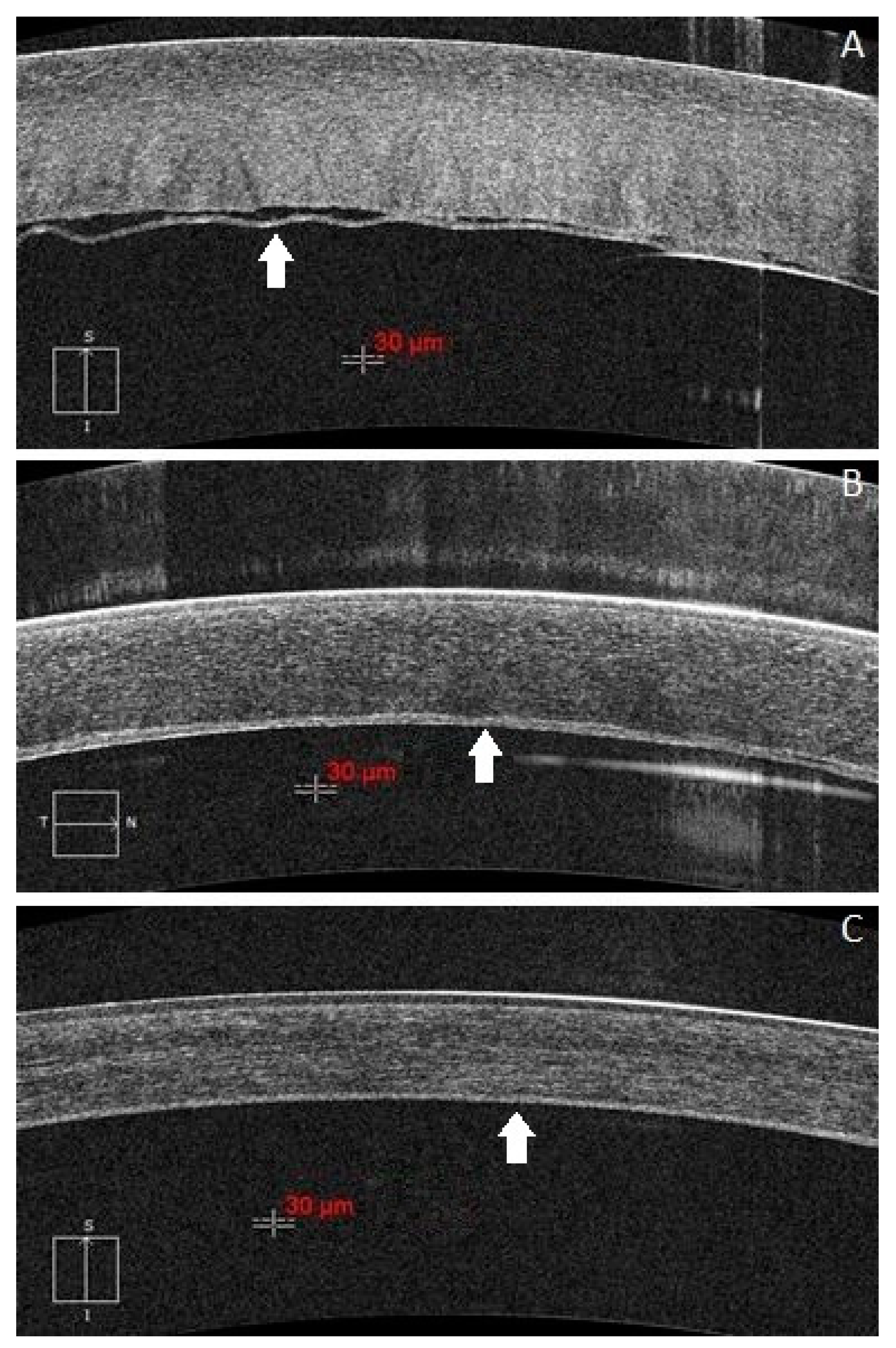 Jcm 11 01534 g002 550