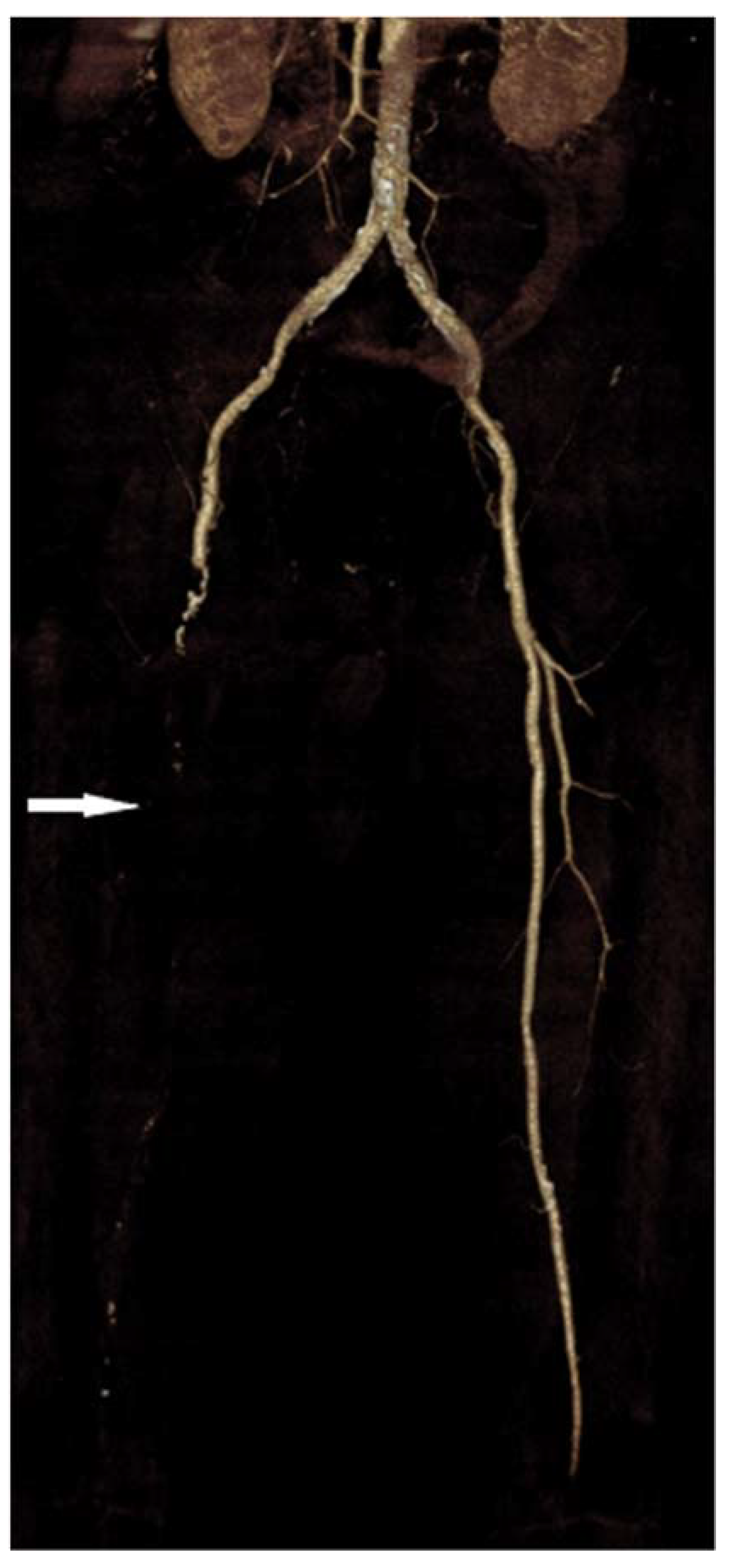 Jcm 11 01538 g004 550