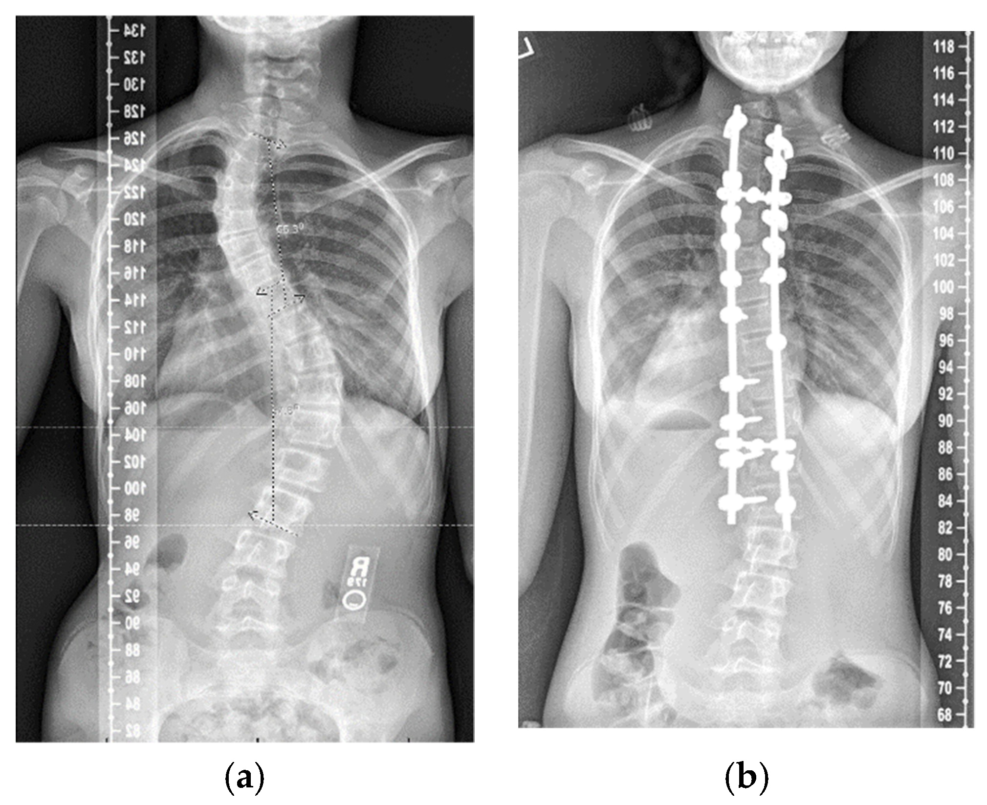 Jcm 11 01545 g003 Jcm 11 01545 g003