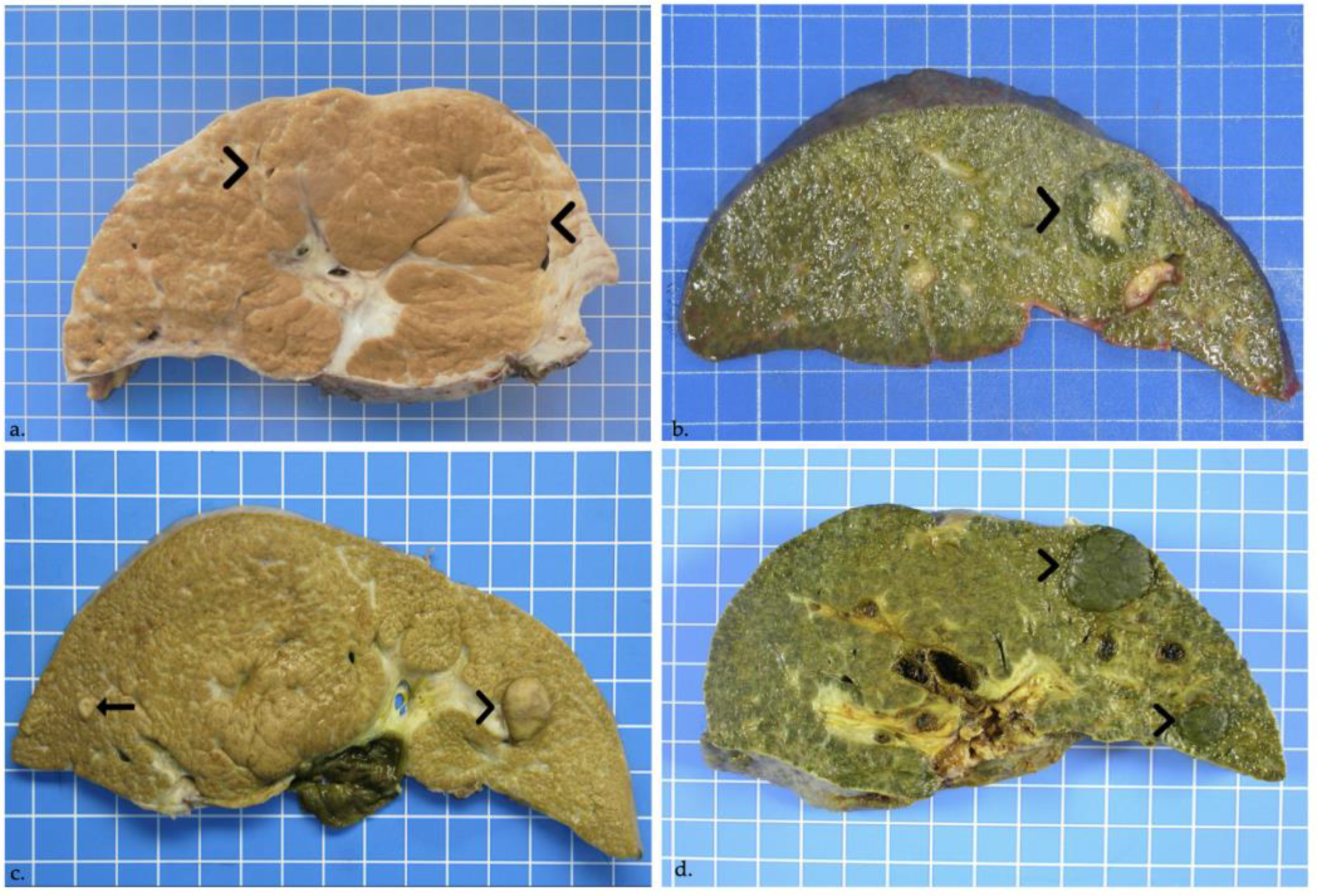 Jcm 11 01578 g003 Jcm 11 01578 g003