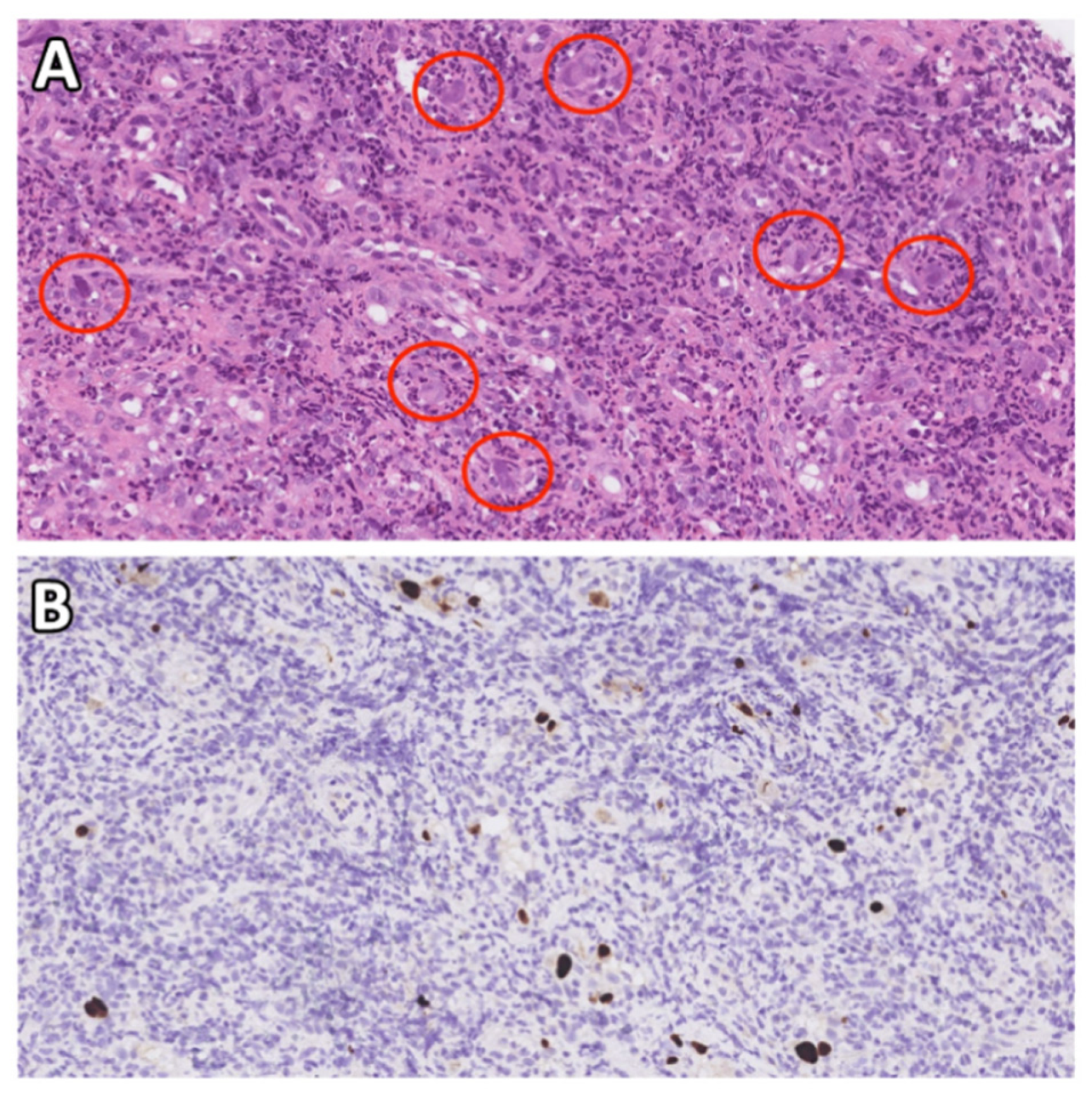 Jcm 11 01583 g001 Jcm 11 01583 g001