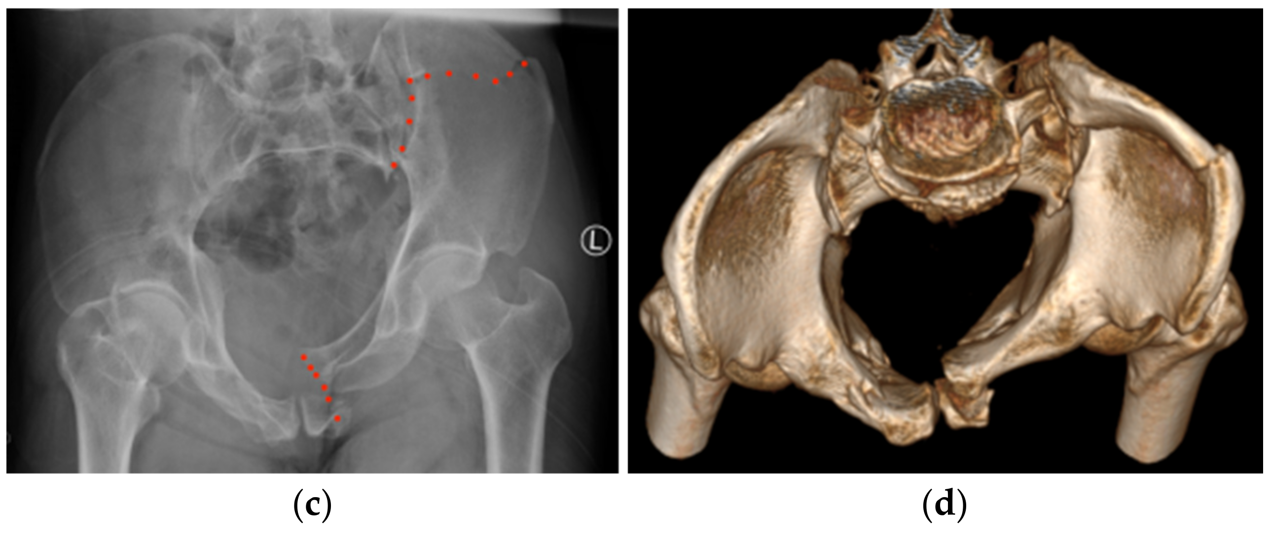 Jcm 11 01598 g002b 550