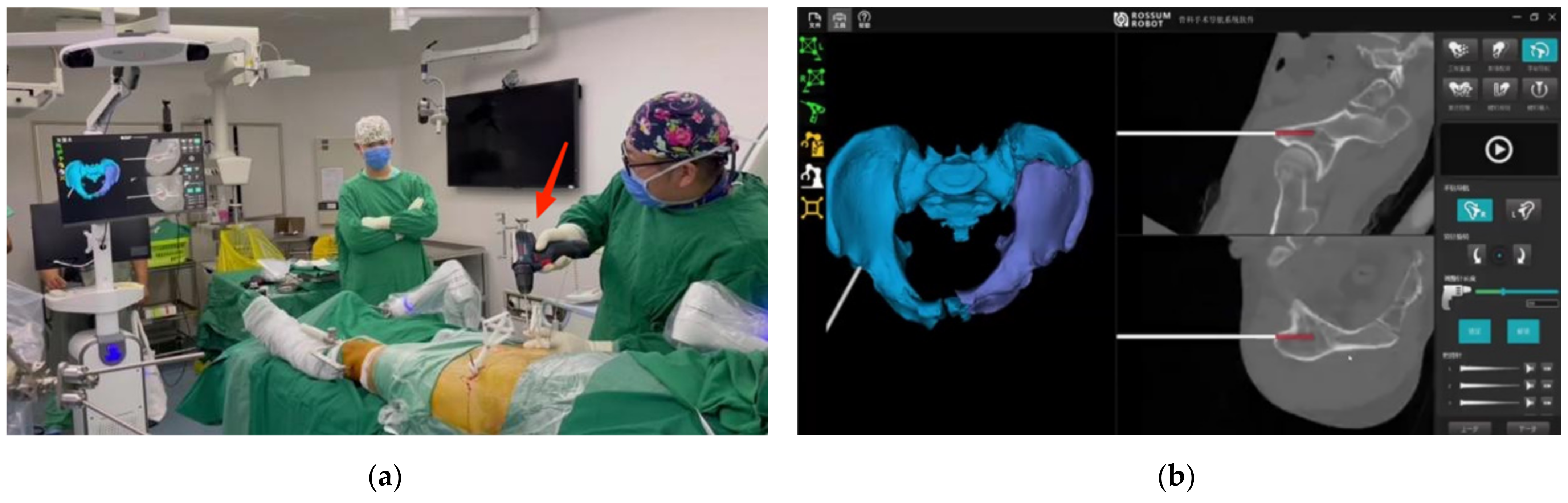 Jcm 11 01598 g003 550