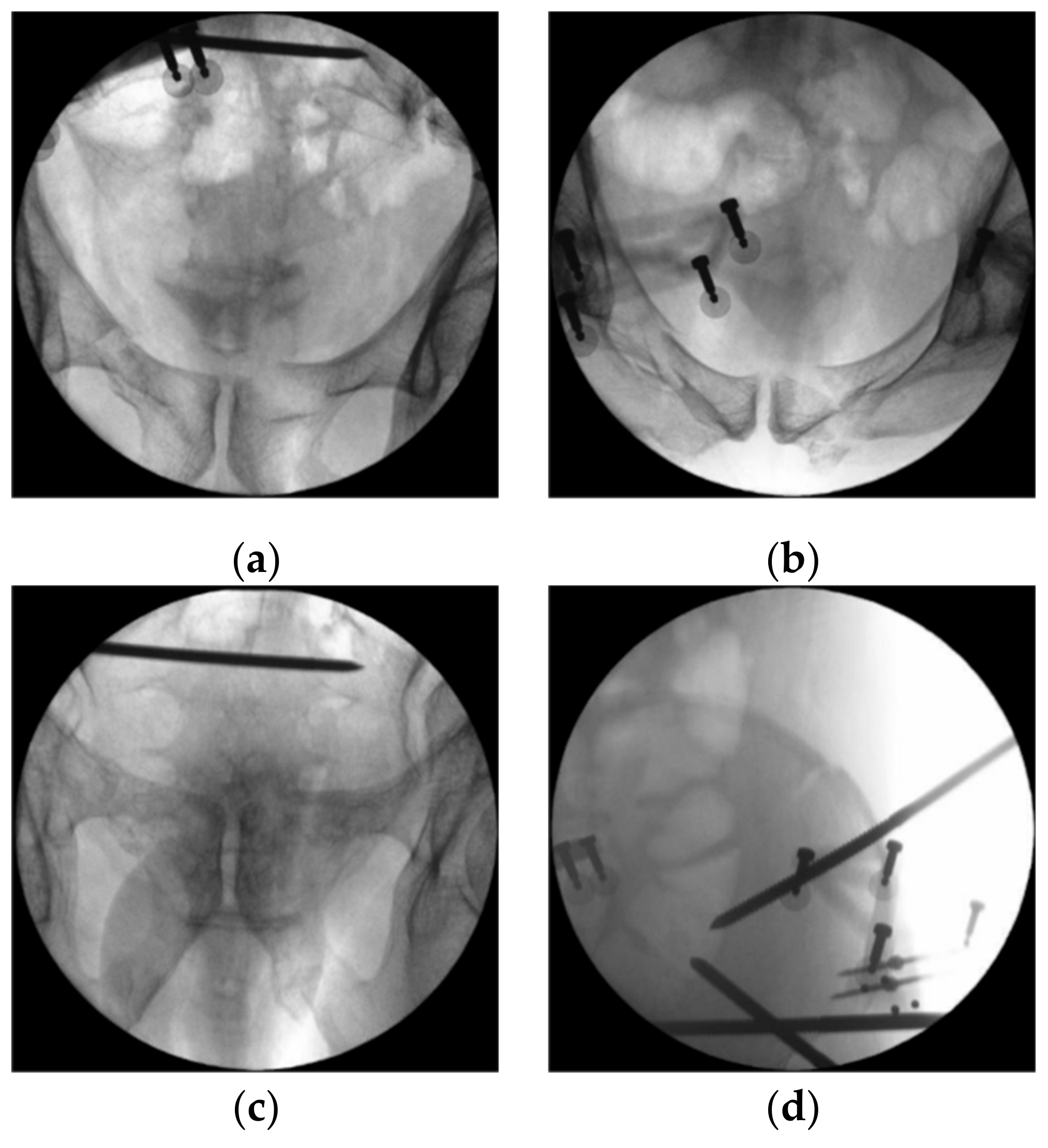 Jcm 11 01598 g004 550