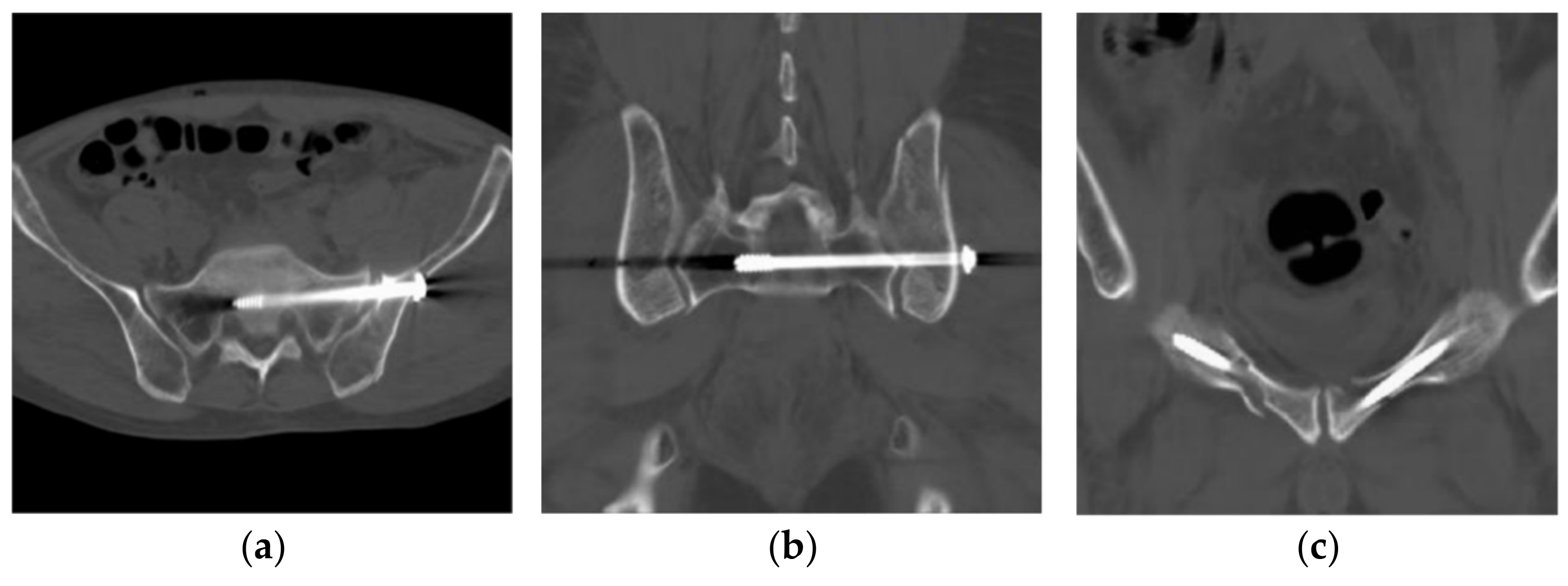 Jcm 11 01598 g005 550