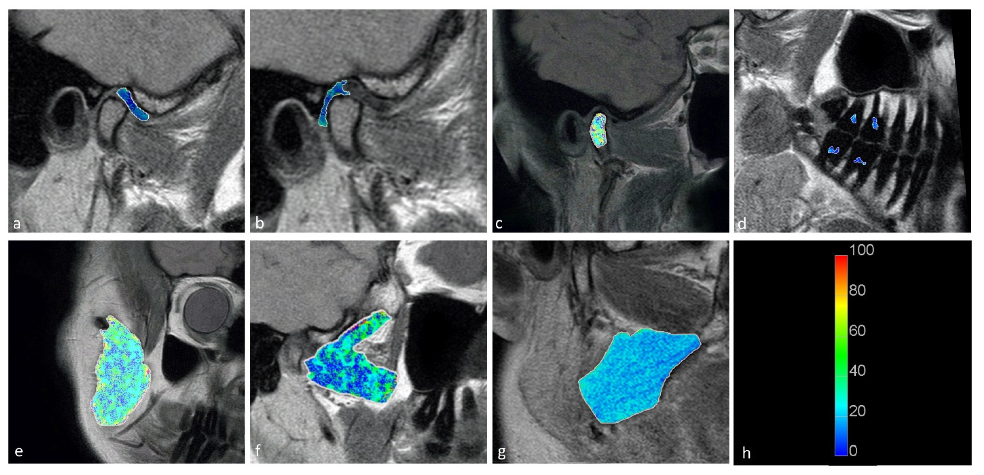 Jcm 11 01621 g002 550