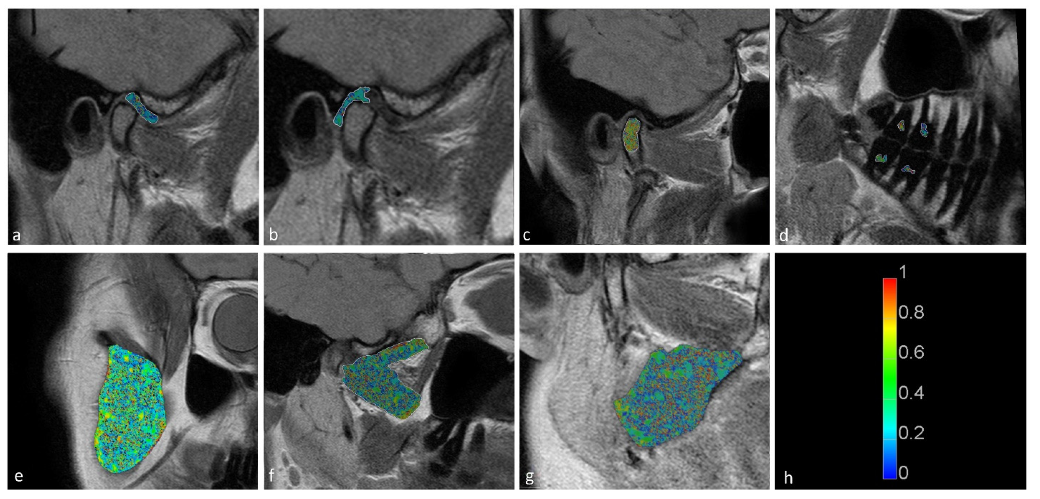 Jcm 11 01621 g005 550