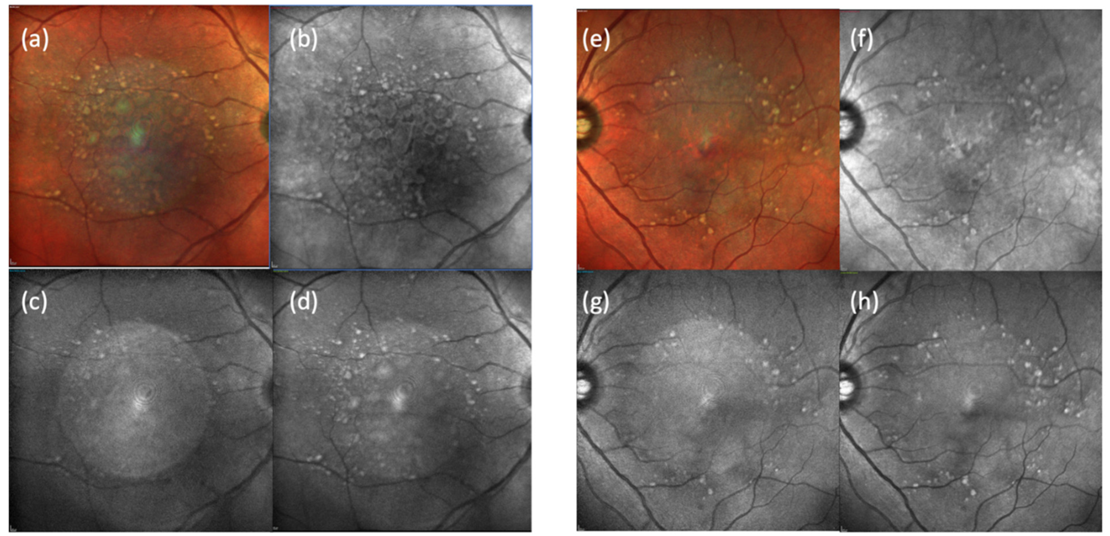 Jcm 11 01637 g002 Jcm 11 01637 g002