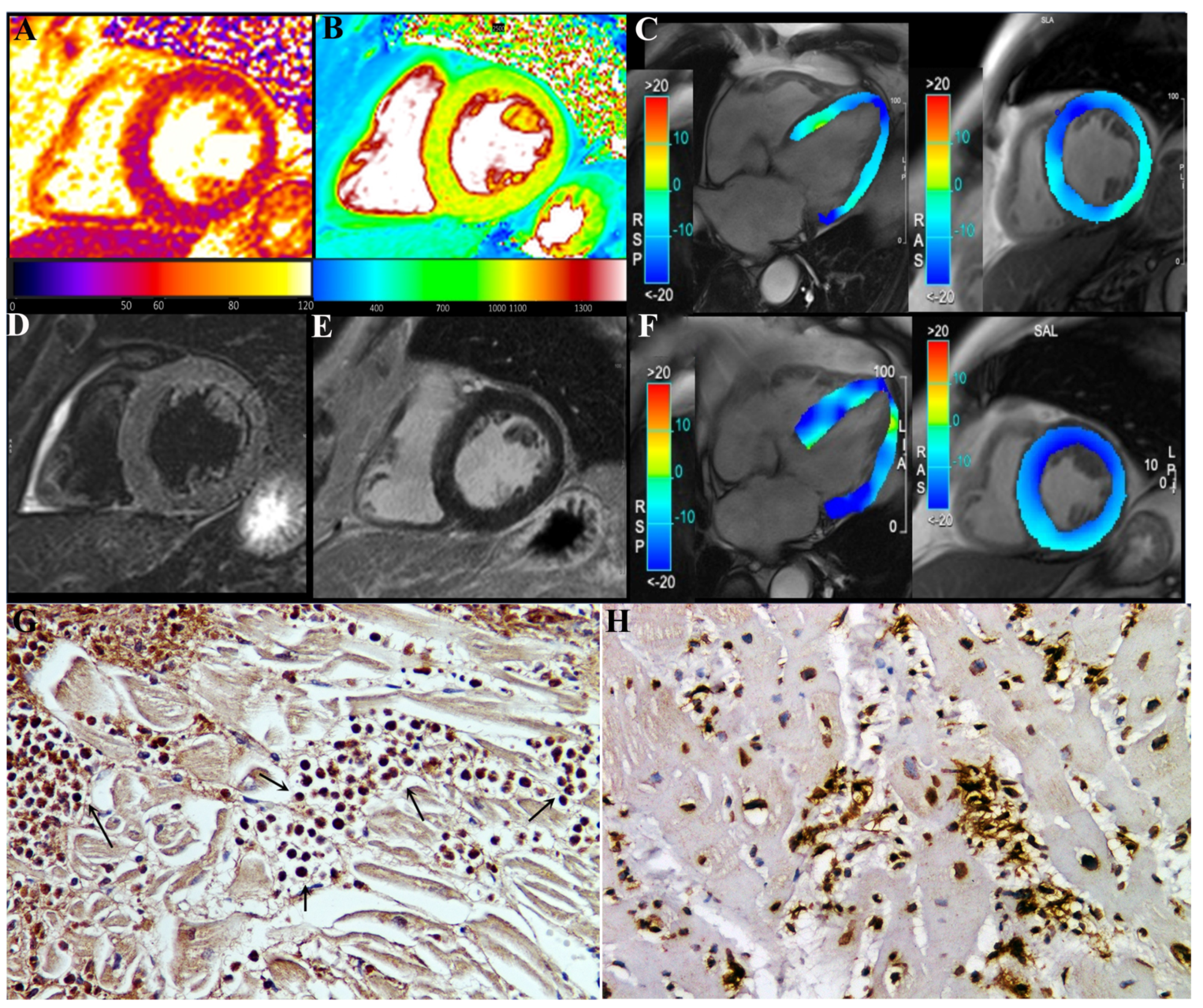 Jcm 11 01660 g003 550