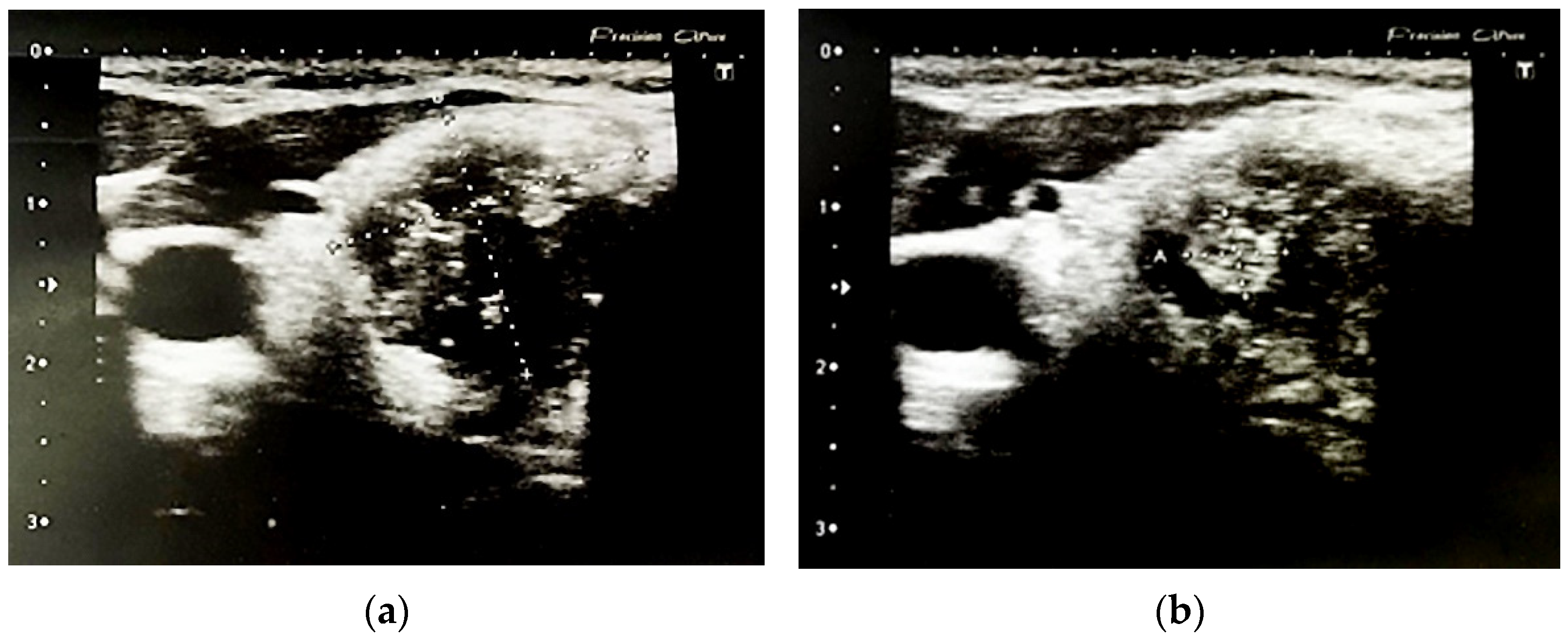 Jcm 11 01768 g002 Jcm 11 01768 g002