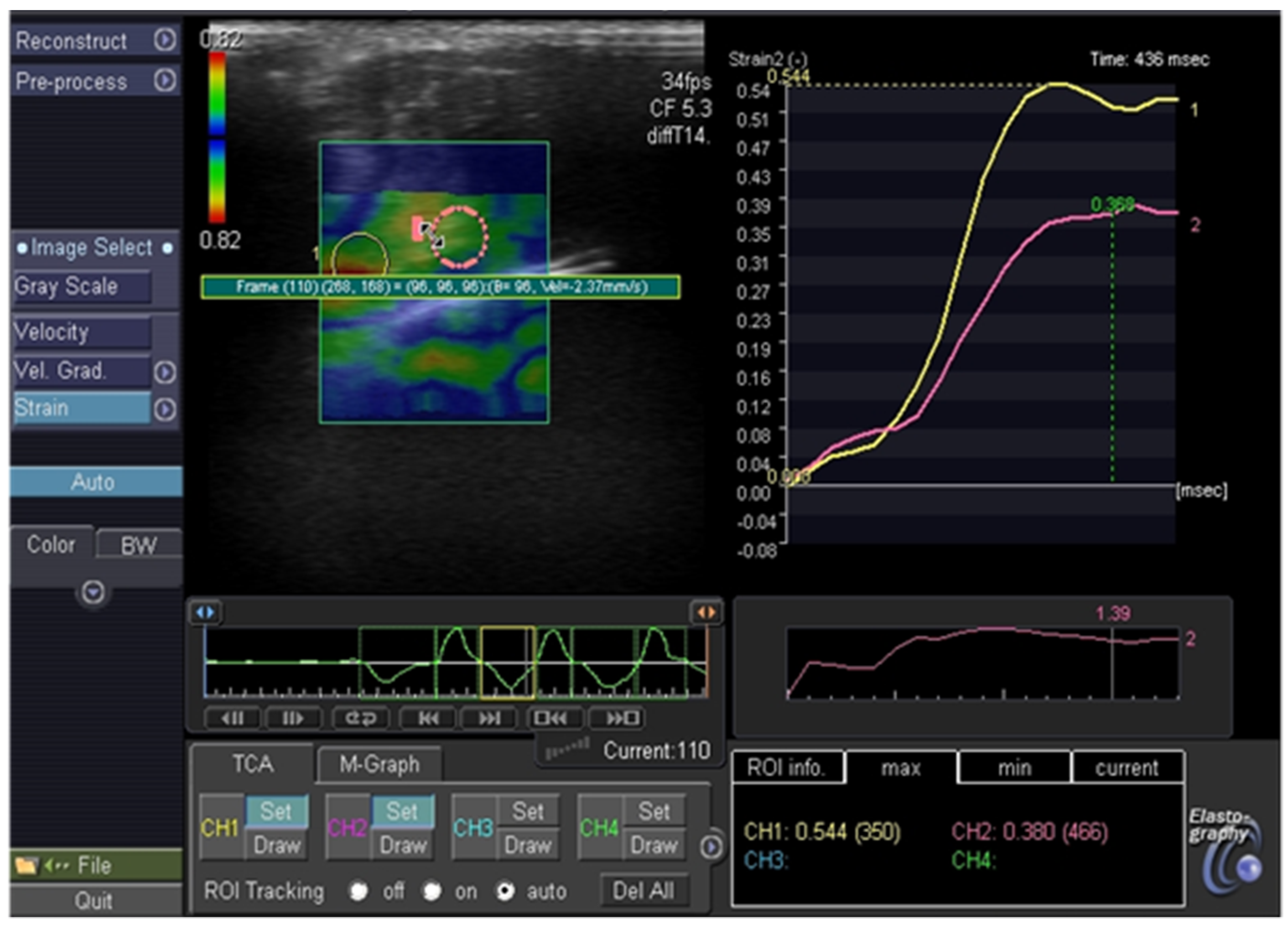 Jcm 11 01768 g005 Jcm 11 01768 g005