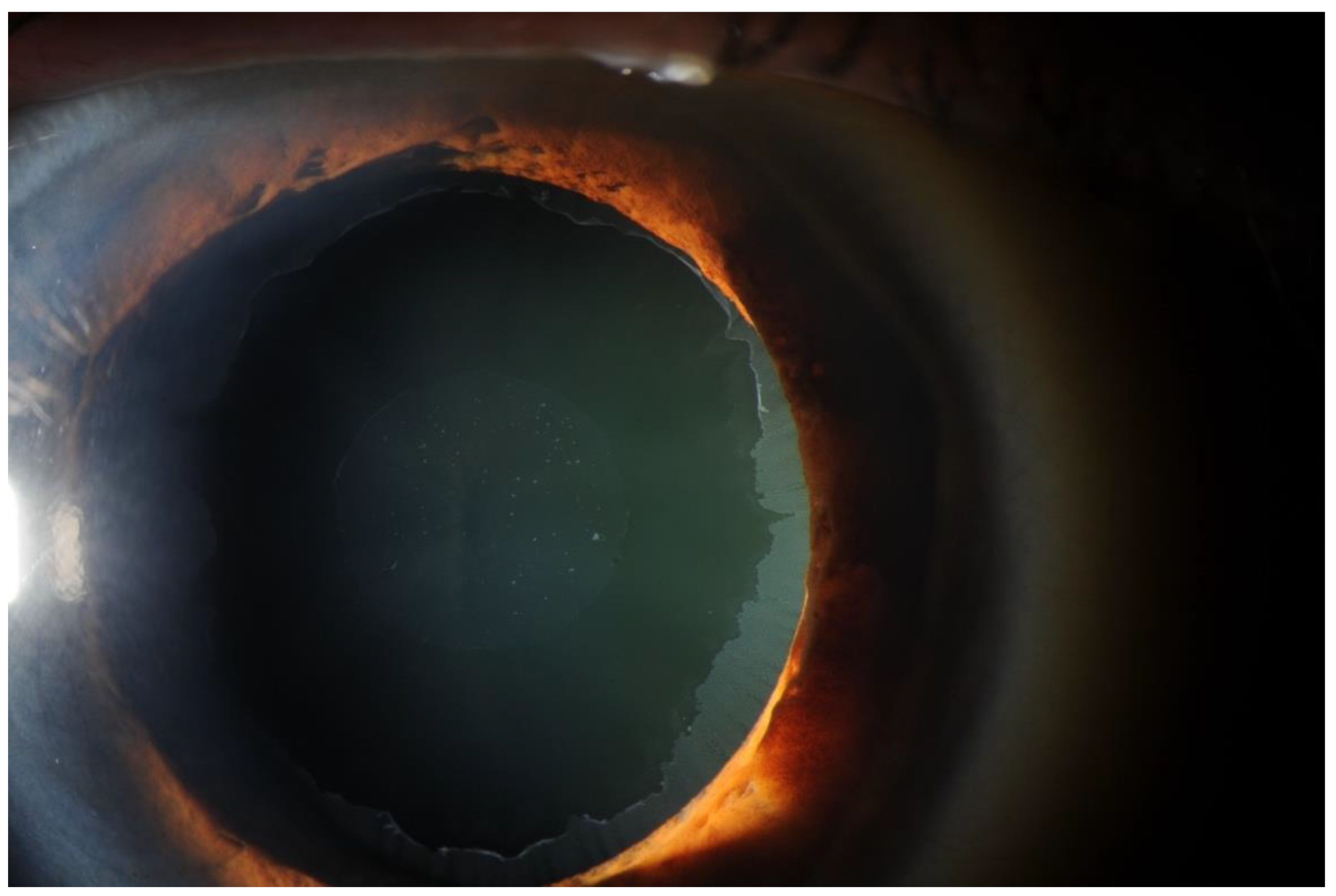 Jcm 11 01795 g001 550