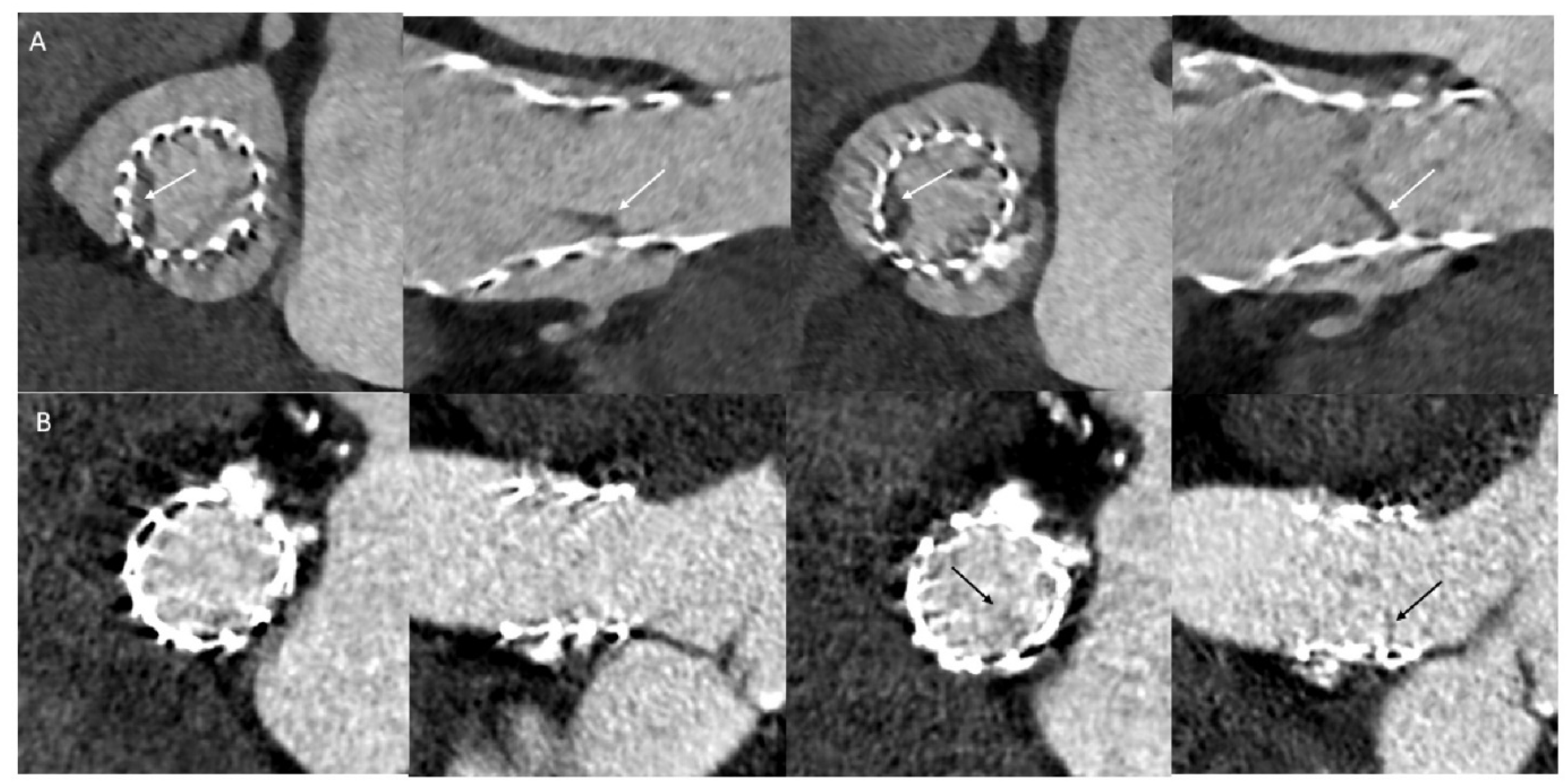 Jcm 11 01817 g001 550