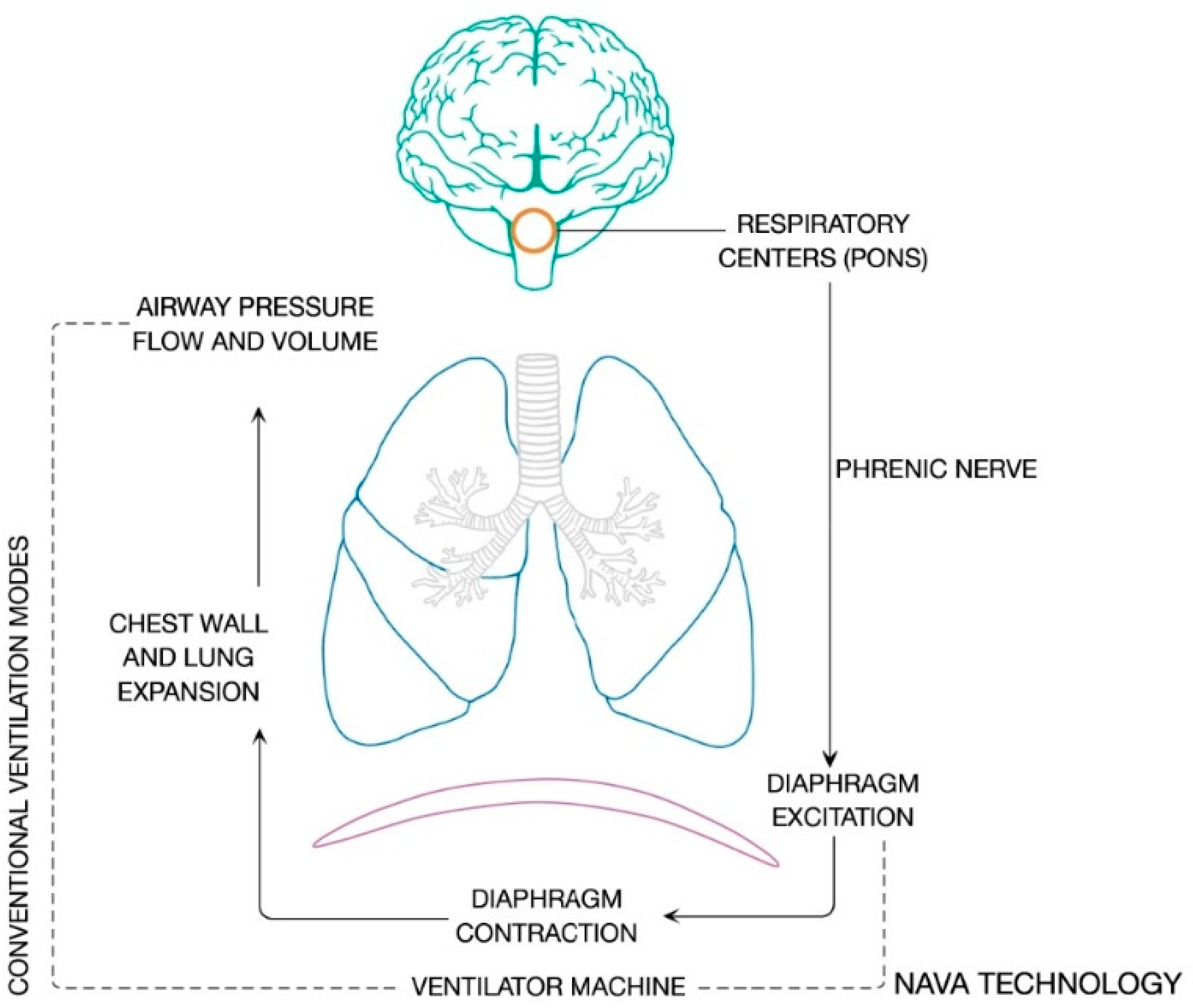 Ganar leyendo Escupir JCM | Free Full-Text | Neurally Adjusted Ventilatory Assist in Acute Respiratory Failure—A Narrative Review Ganar leyendo Escupir JCM | Free Full-Text | Neurally Adjusted Ventilatory Assist in Acute Respiratory Failure—A Narrative Review