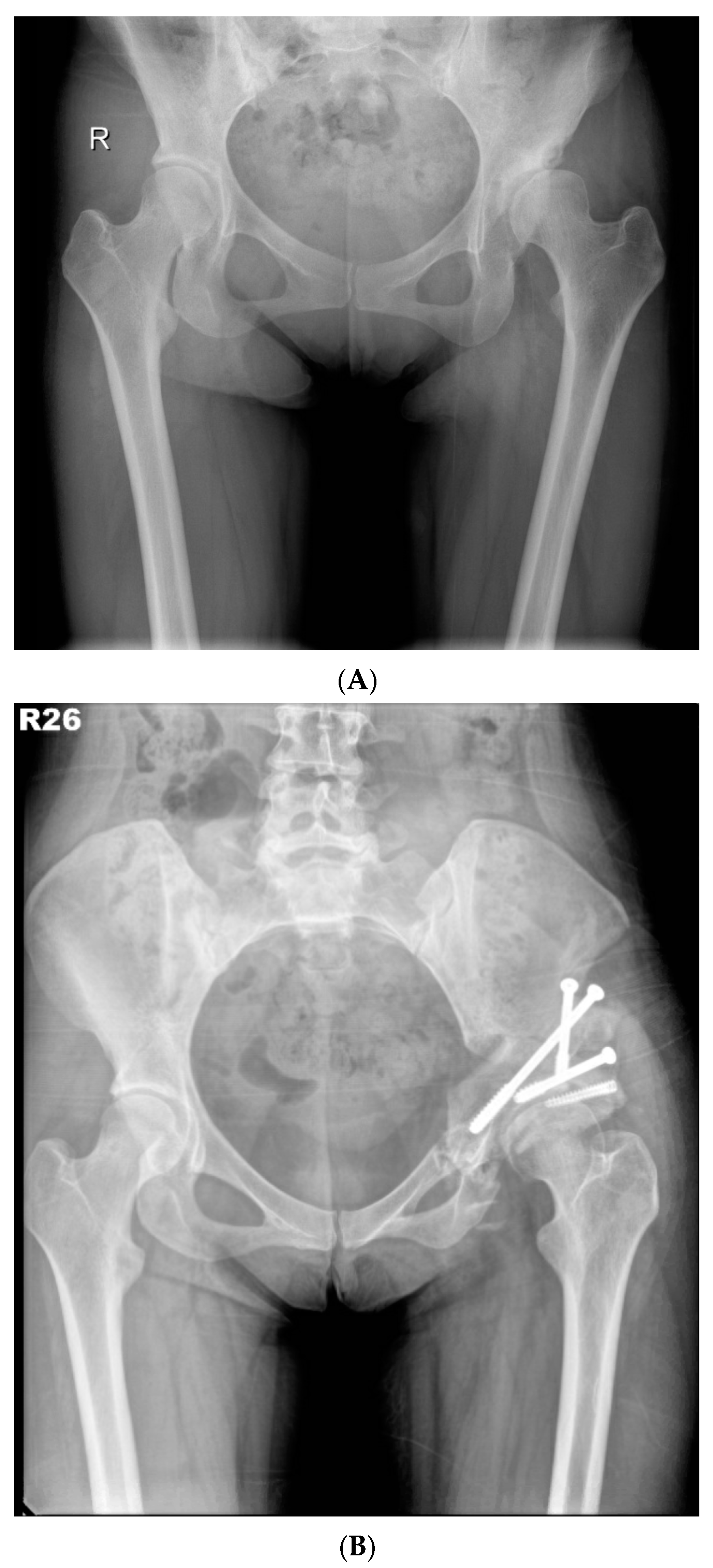 Jcm 11 01924 g002 550