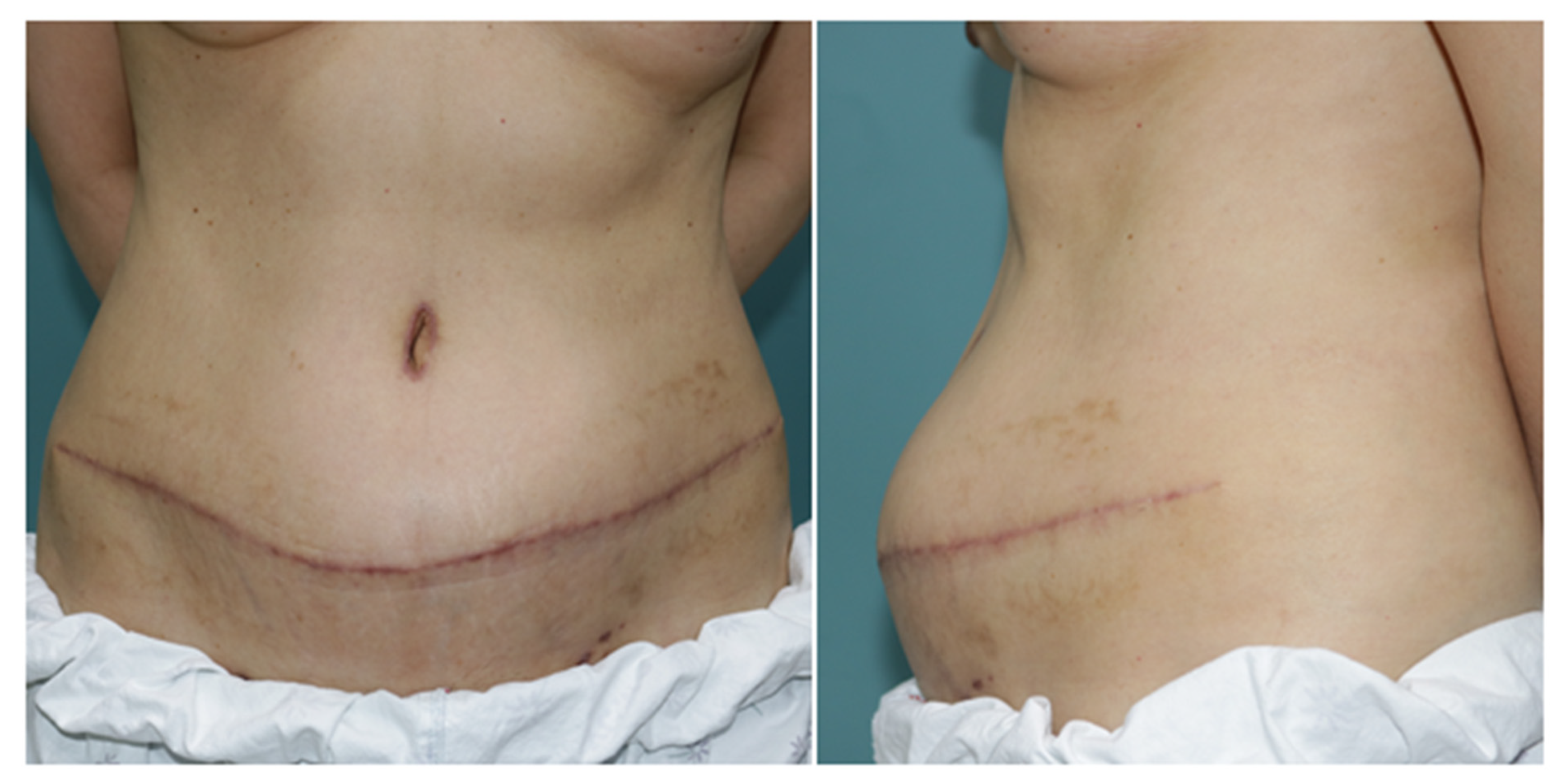 Jcm 11 01929 g002 550