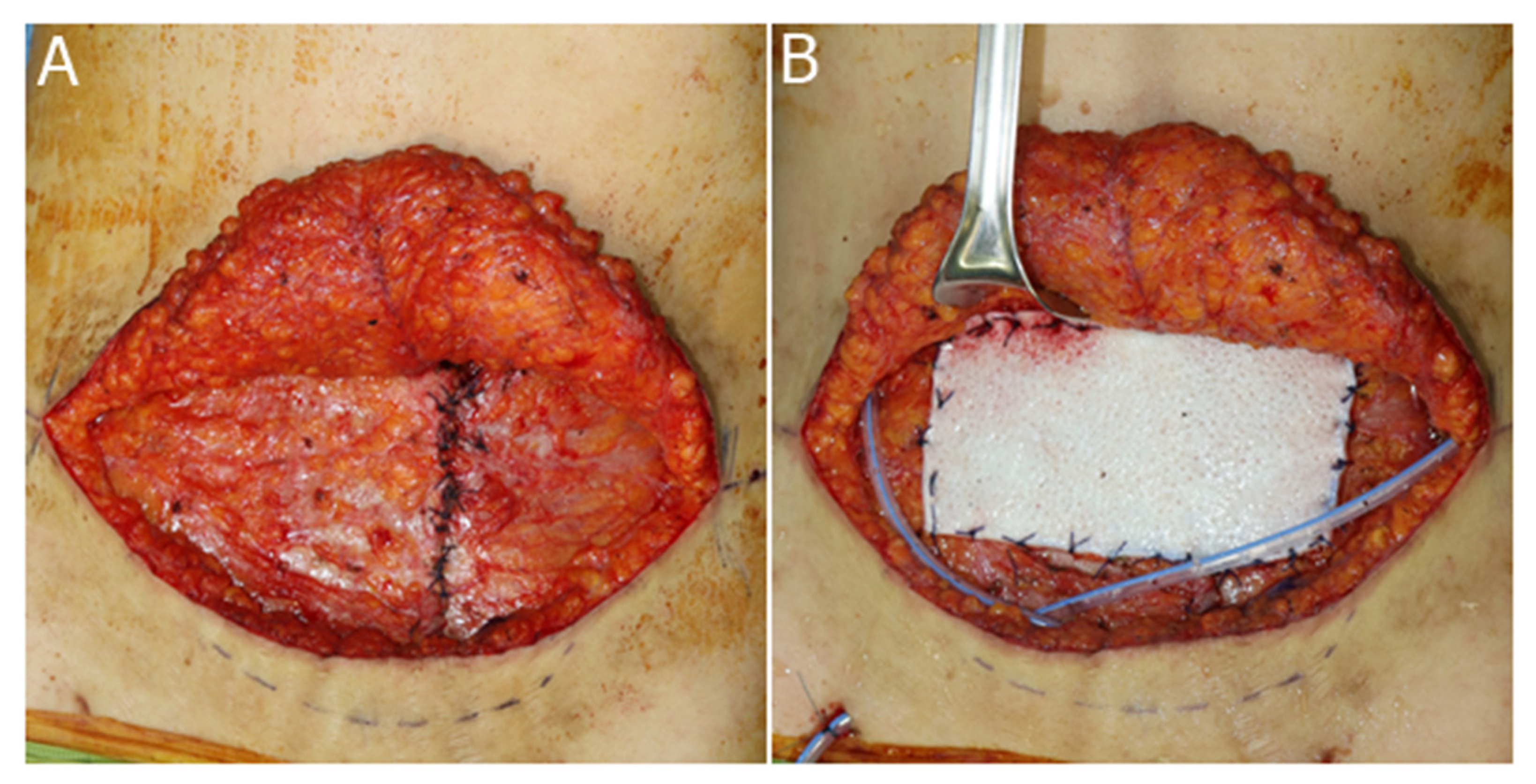 Jcm 11 01929 g003 550