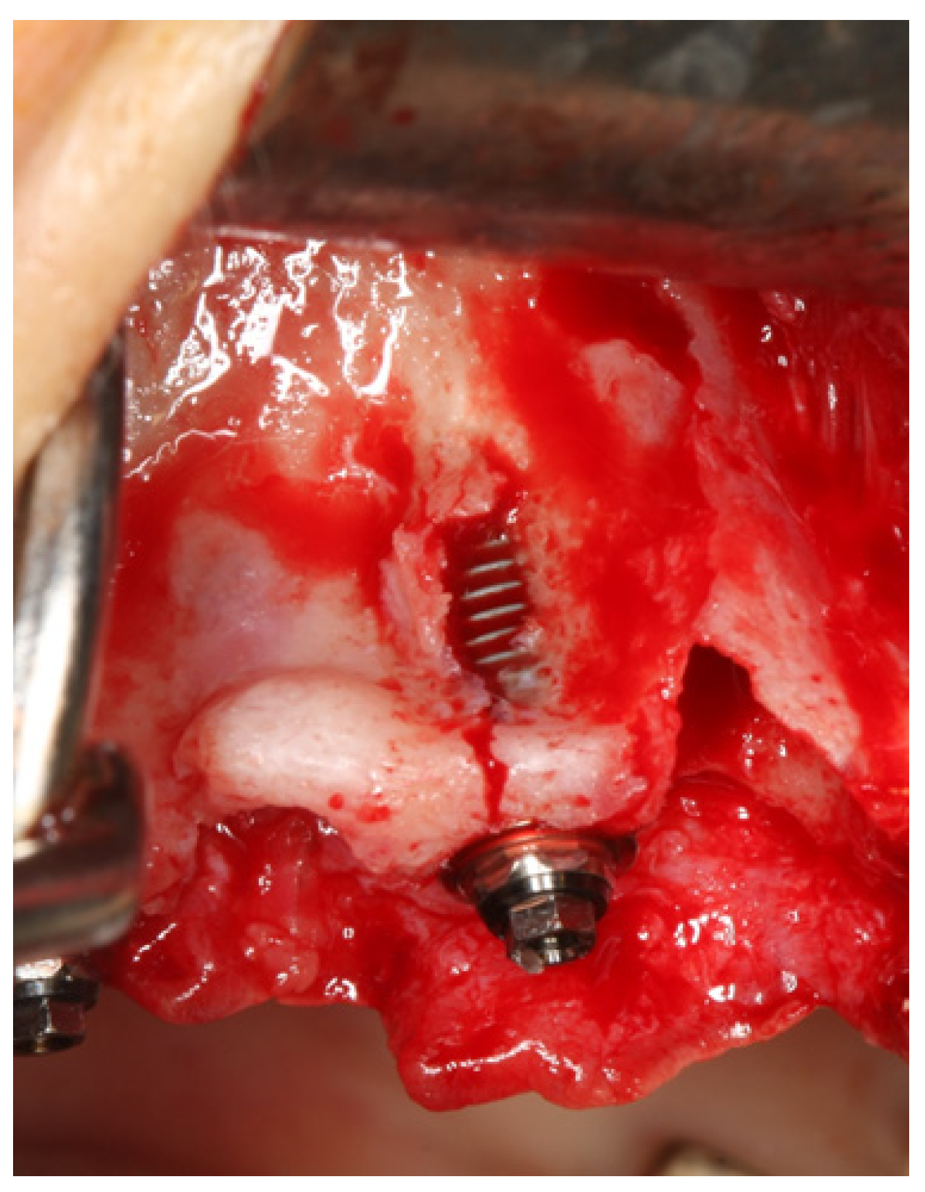 Jcm 11 01939 g002 550