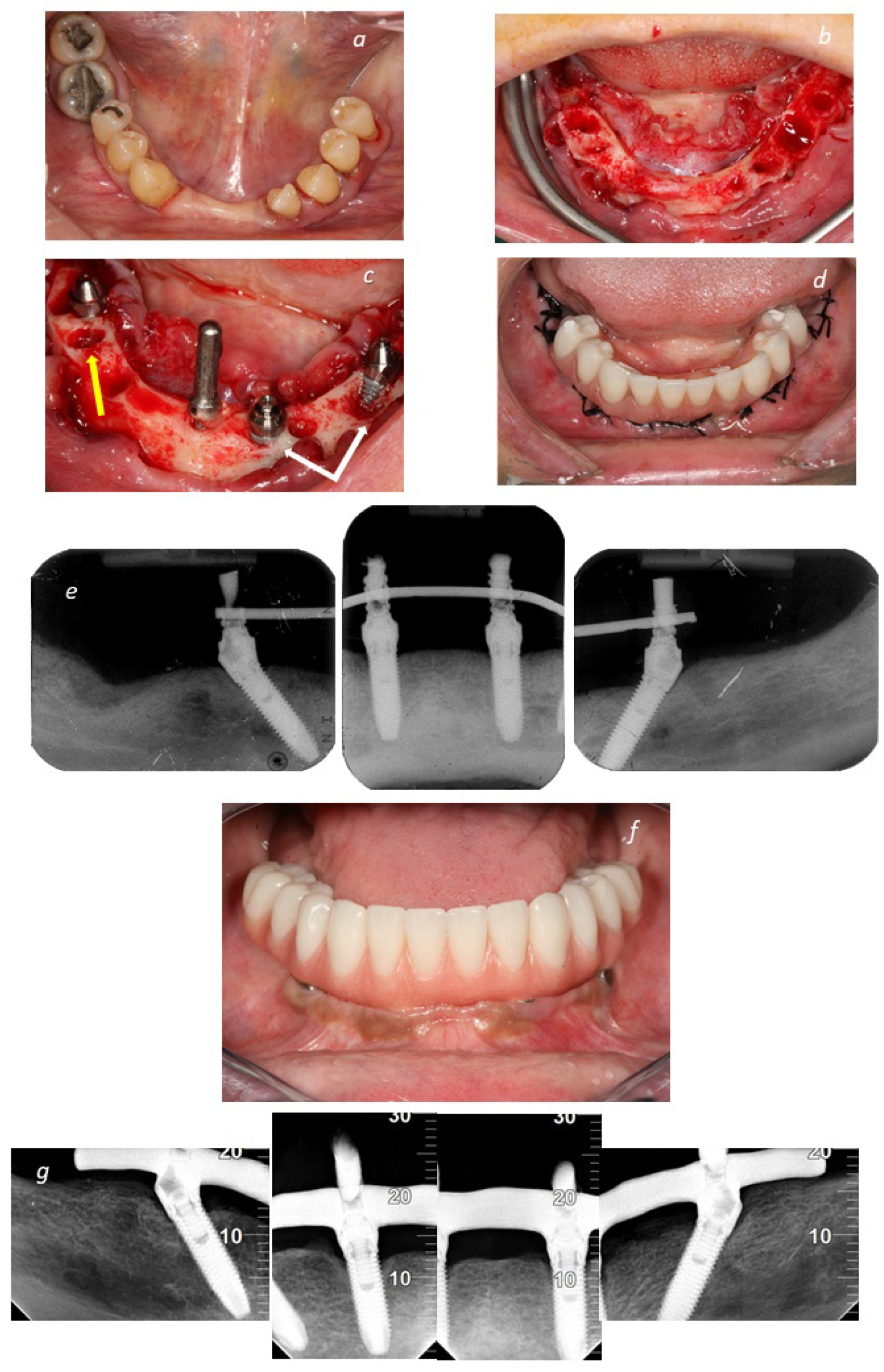 Jcm 11 01939 g003 550