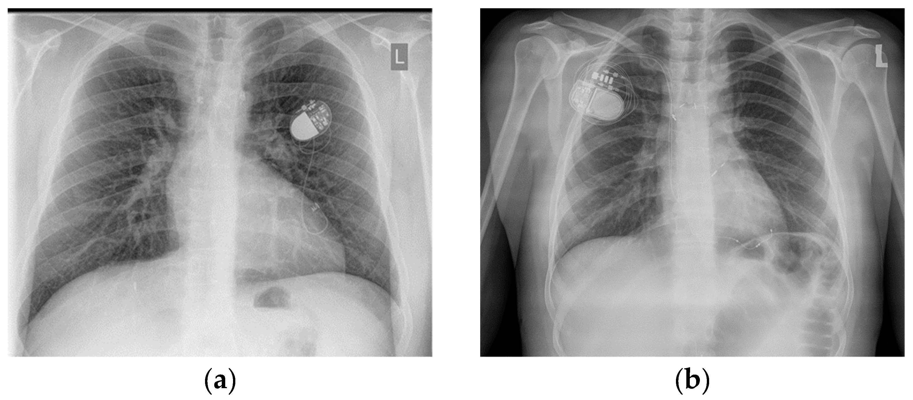 Jcm 11 01968 g002 Jcm 11 01968 g002