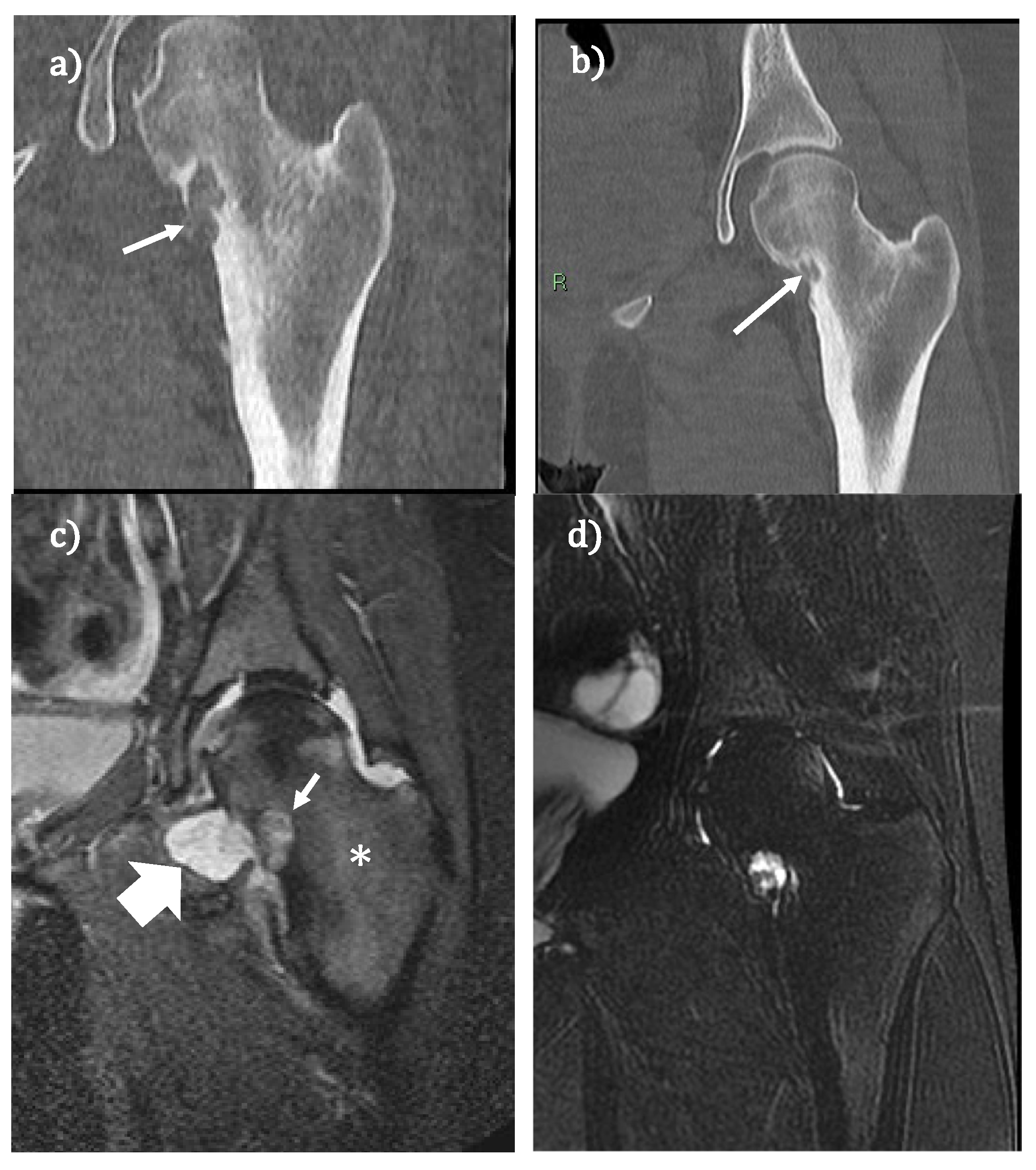 Jcm 11 01987 g002 Jcm 11 01987 g002