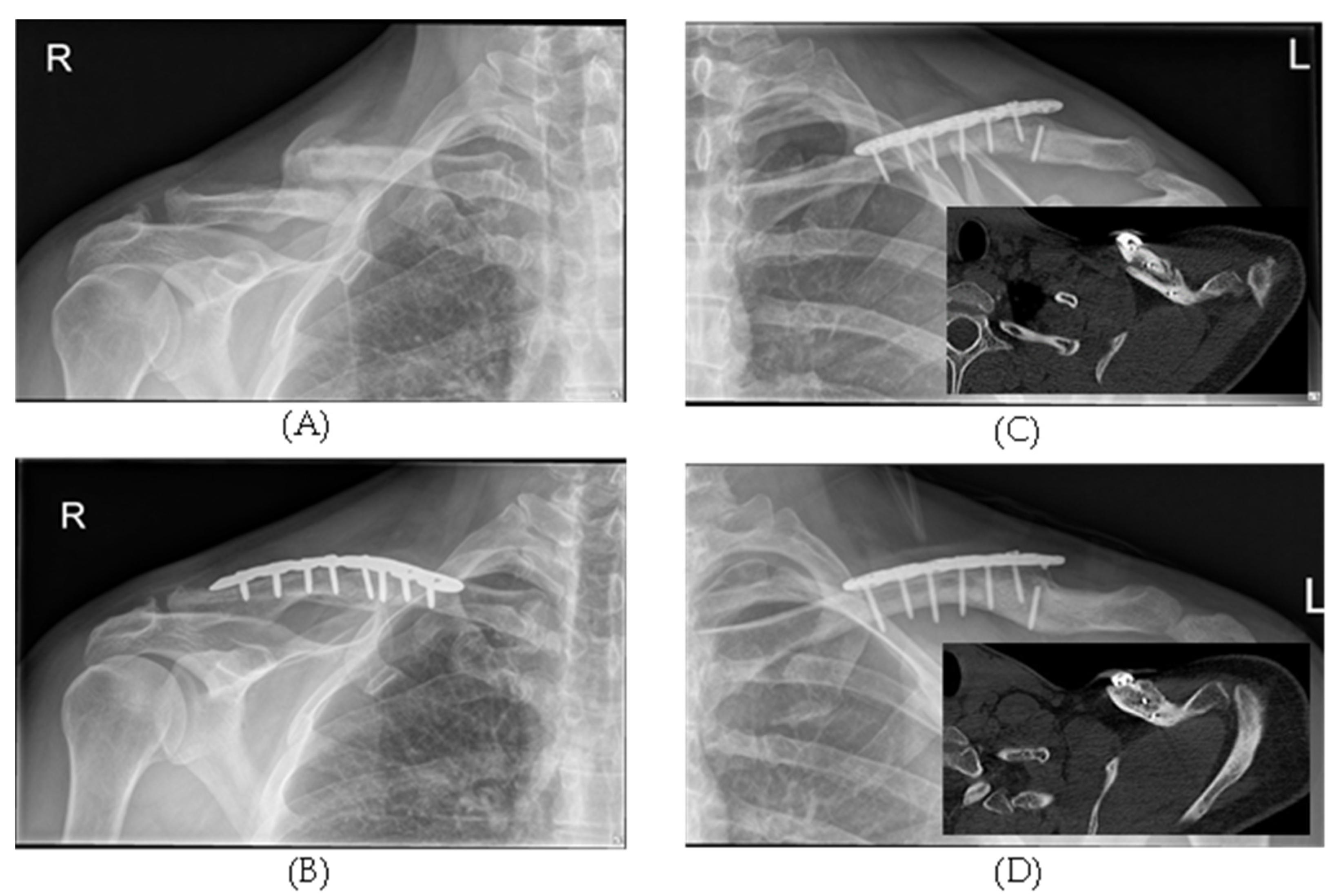 Jcm 11 01988 g002 Jcm 11 01988 g002