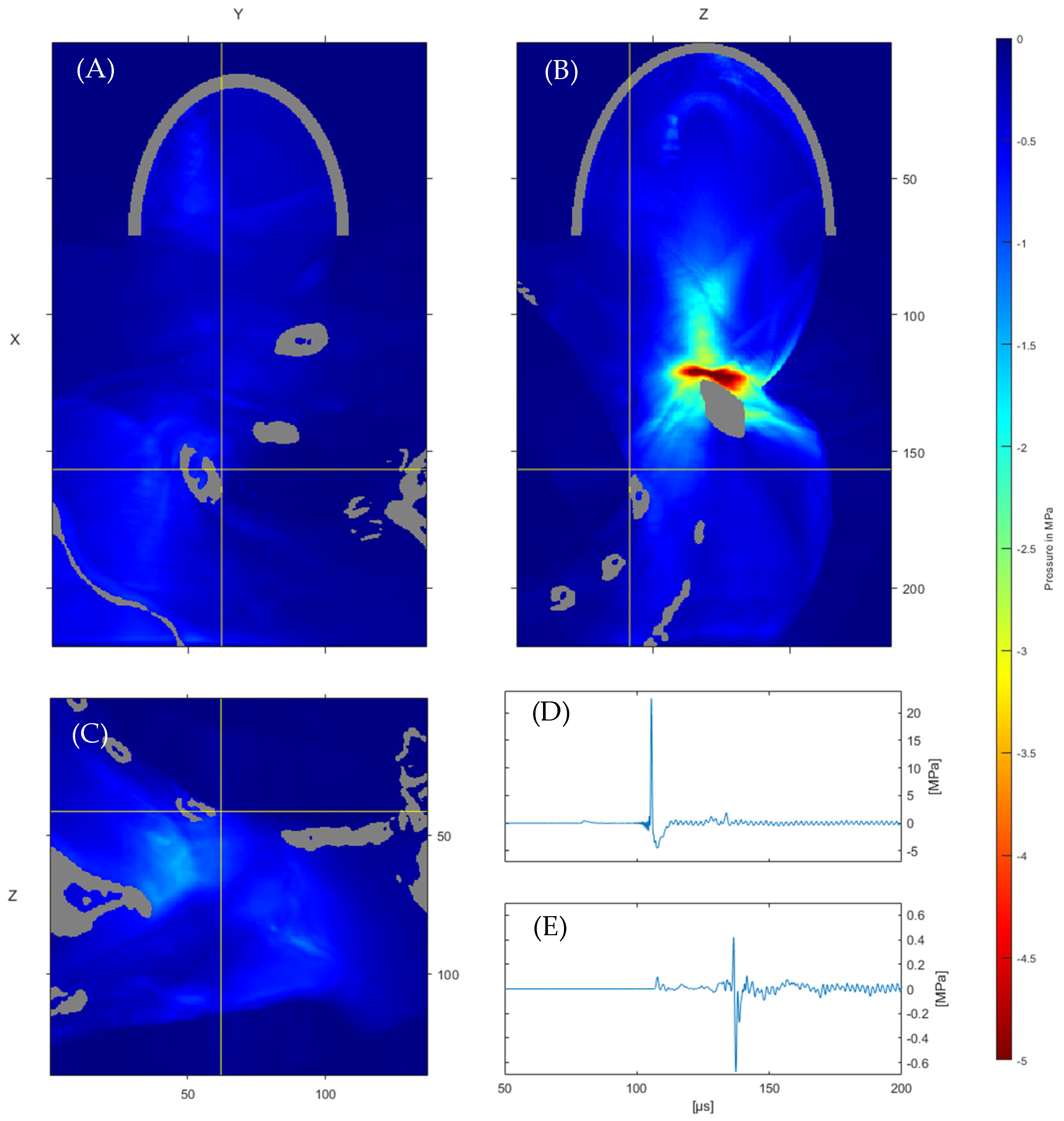 Jcm 11 01988 g004 Jcm 11 01988 g004