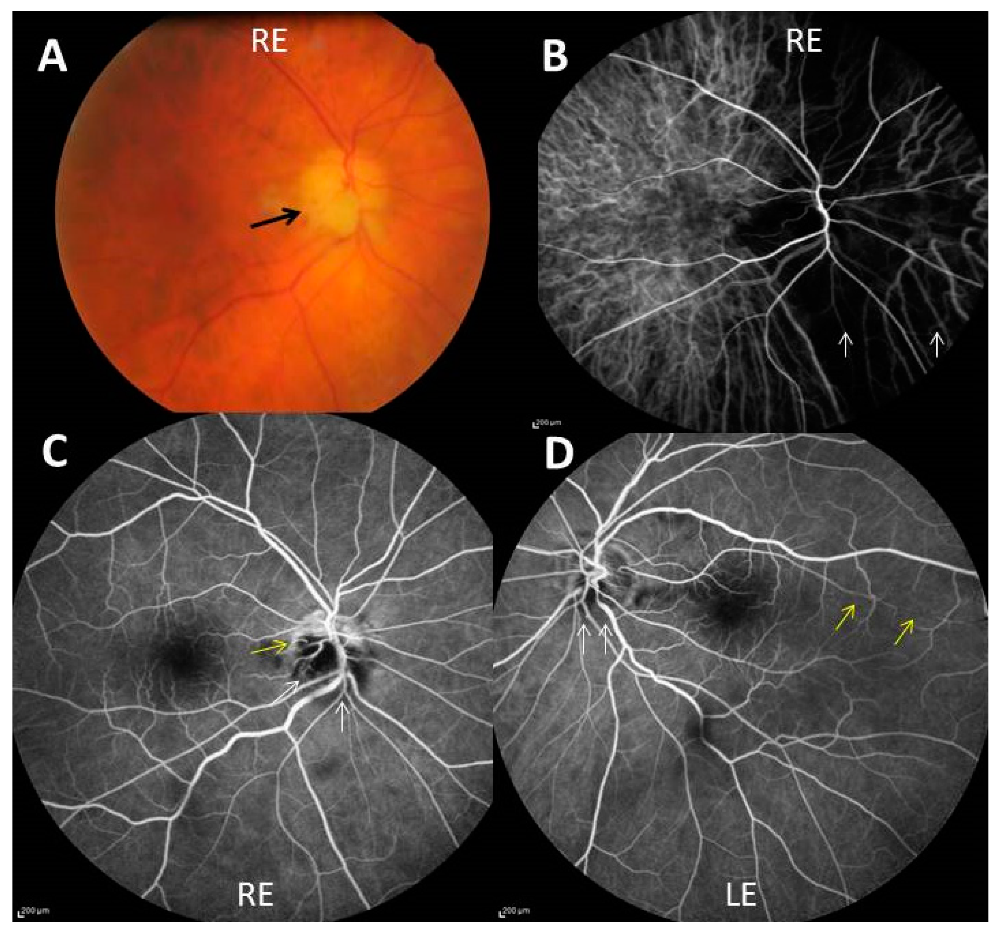 Jcm 11 01997 g001 Jcm 11 01997 g001