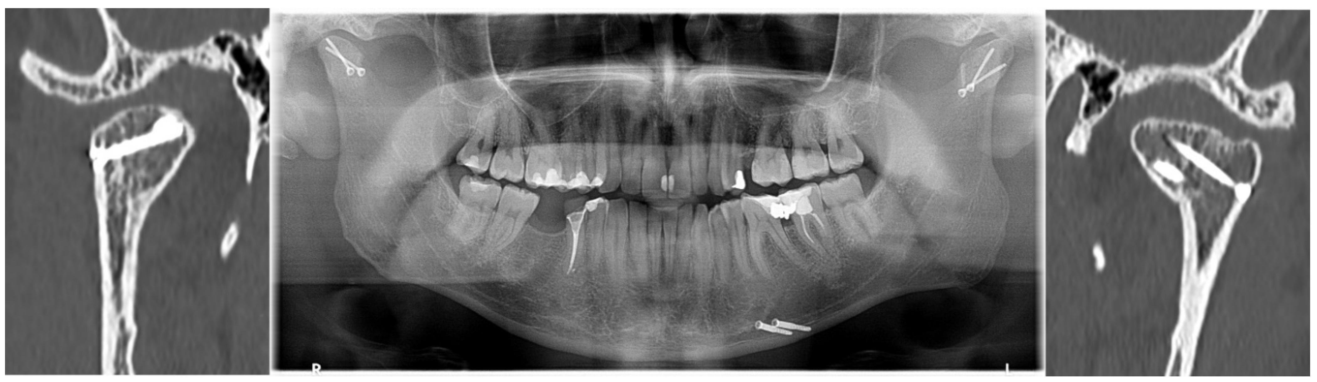 Jcm 11 02031 g001 550