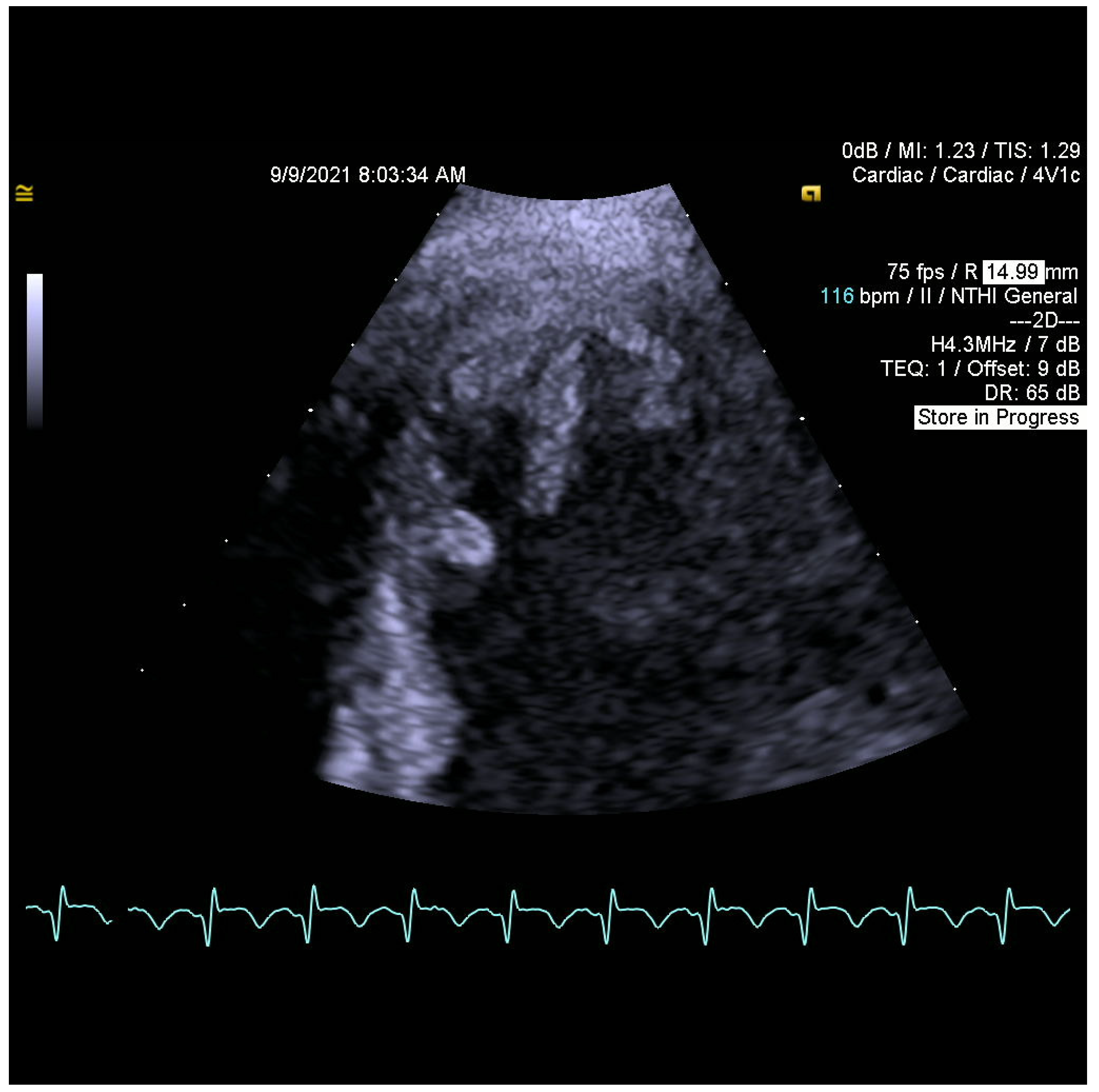 Jcm 11 02038 g002 Jcm 11 02038 g002