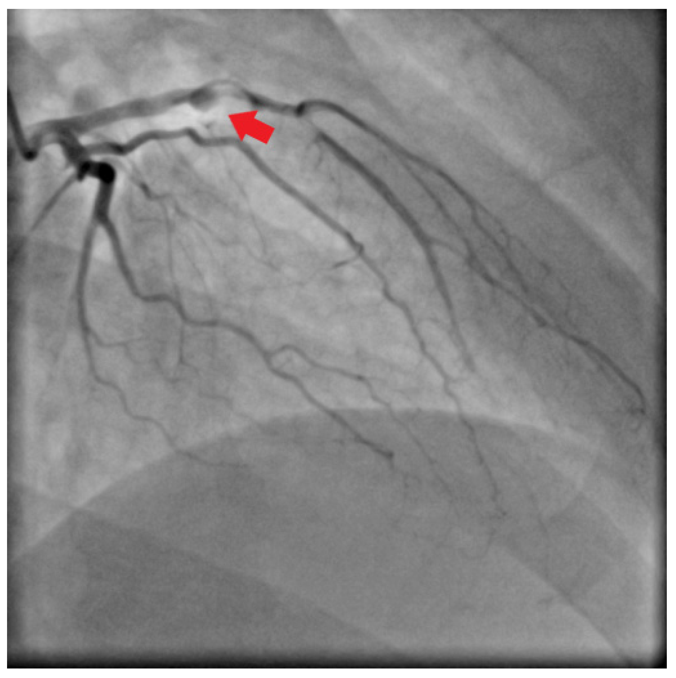 Jcm 11 02038 g003 Jcm 11 02038 g003