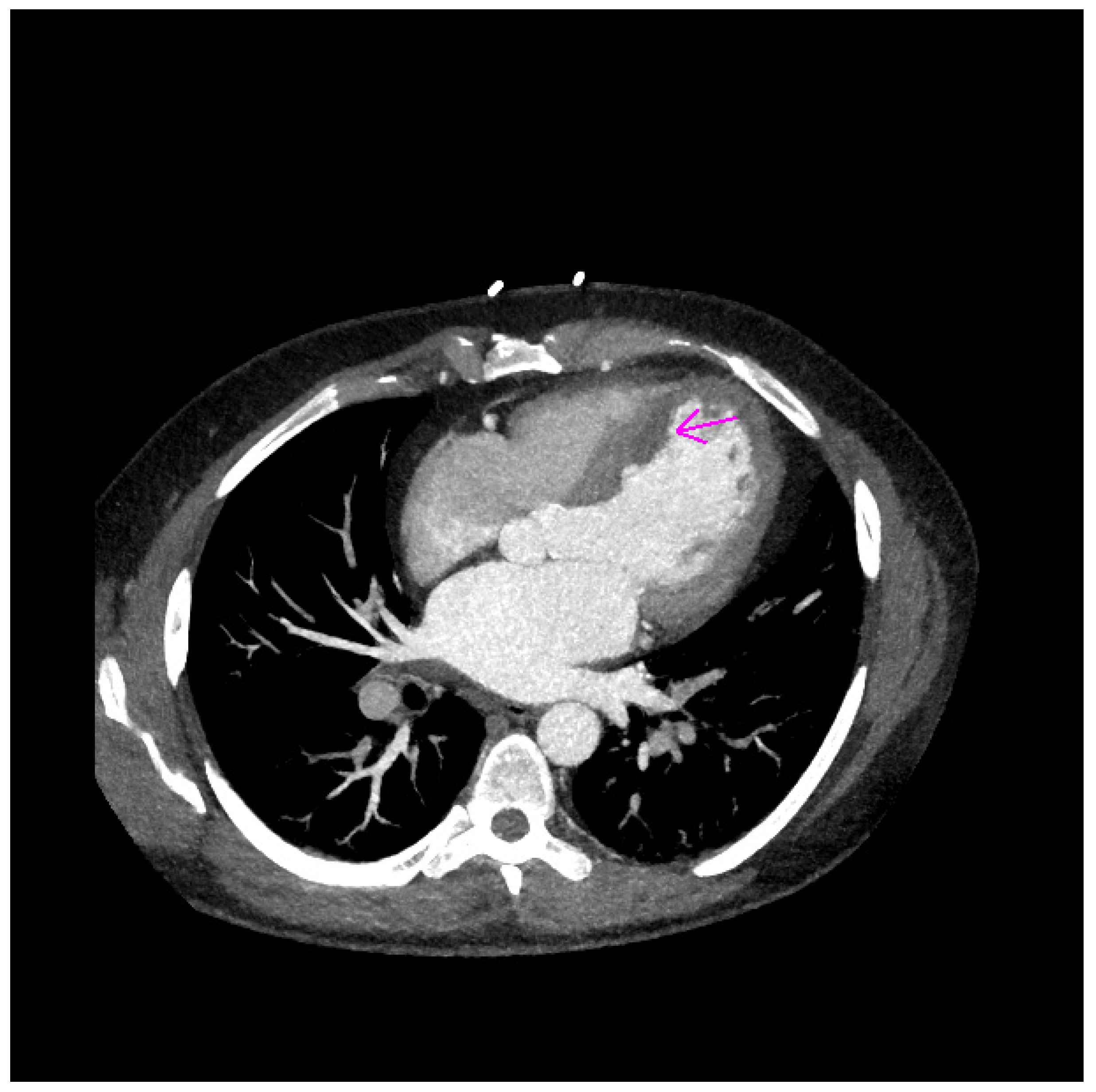Jcm 11 02038 g005 Jcm 11 02038 g005