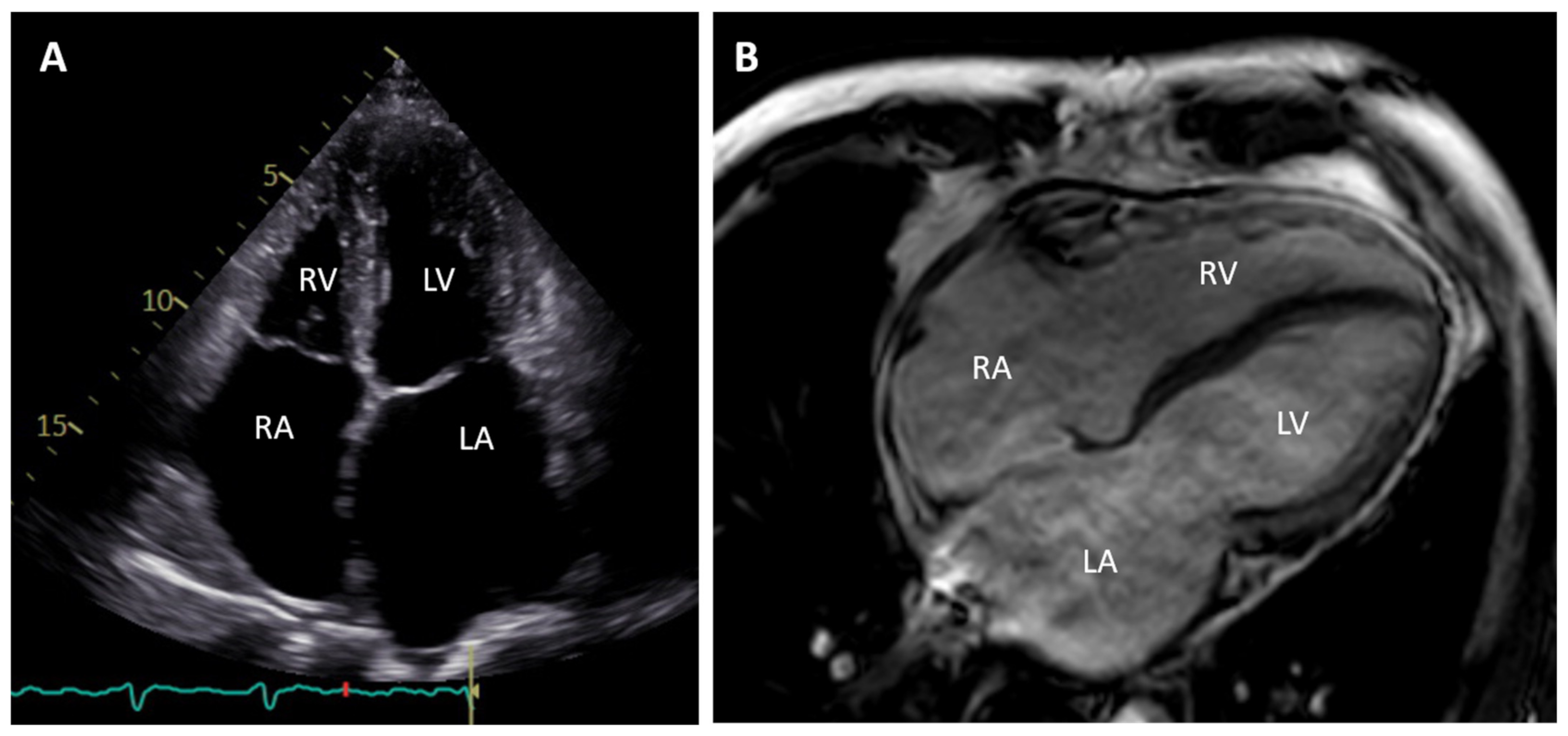 Jcm 11 02094 g001 Jcm 11 02094 g001