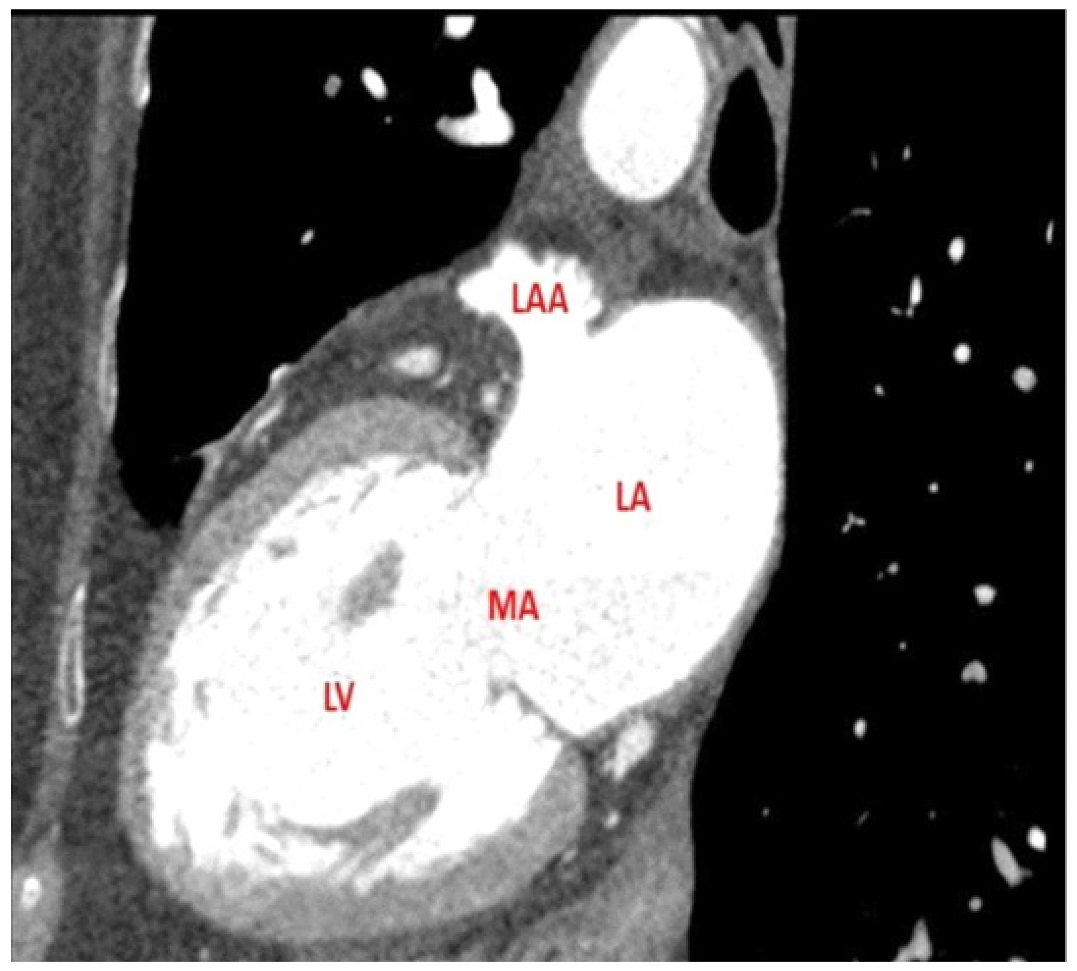 Jcm 11 02101 g001 Jcm 11 02101 g001