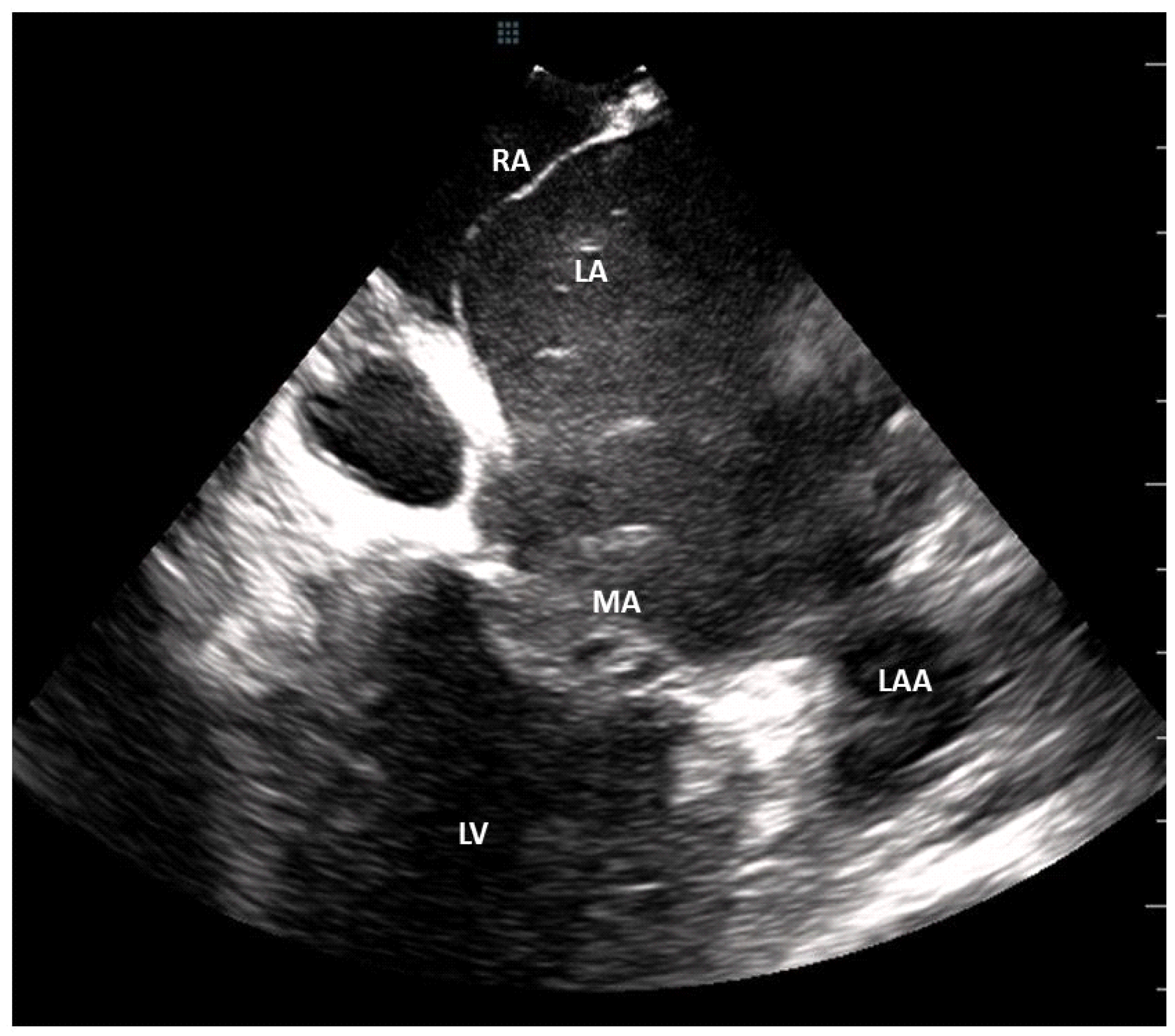 Jcm 11 02101 g002 Jcm 11 02101 g002
