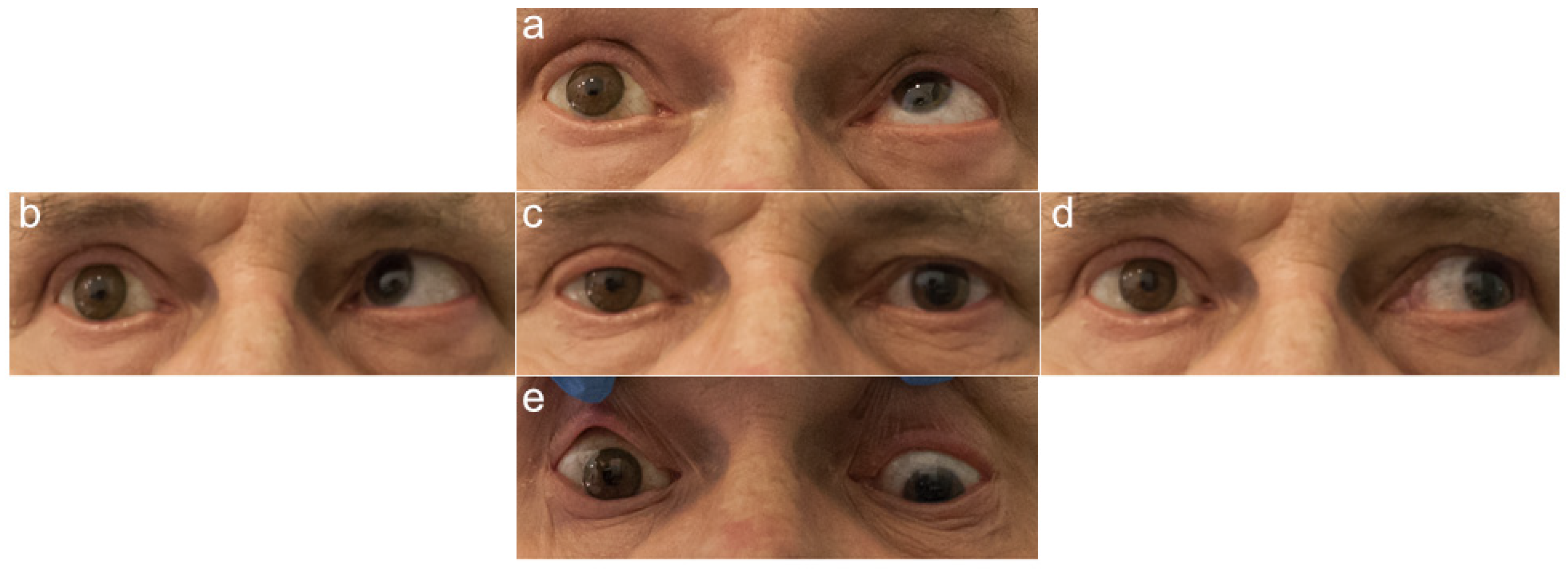 Jcm 11 02141 g002 Jcm 11 02141 g002